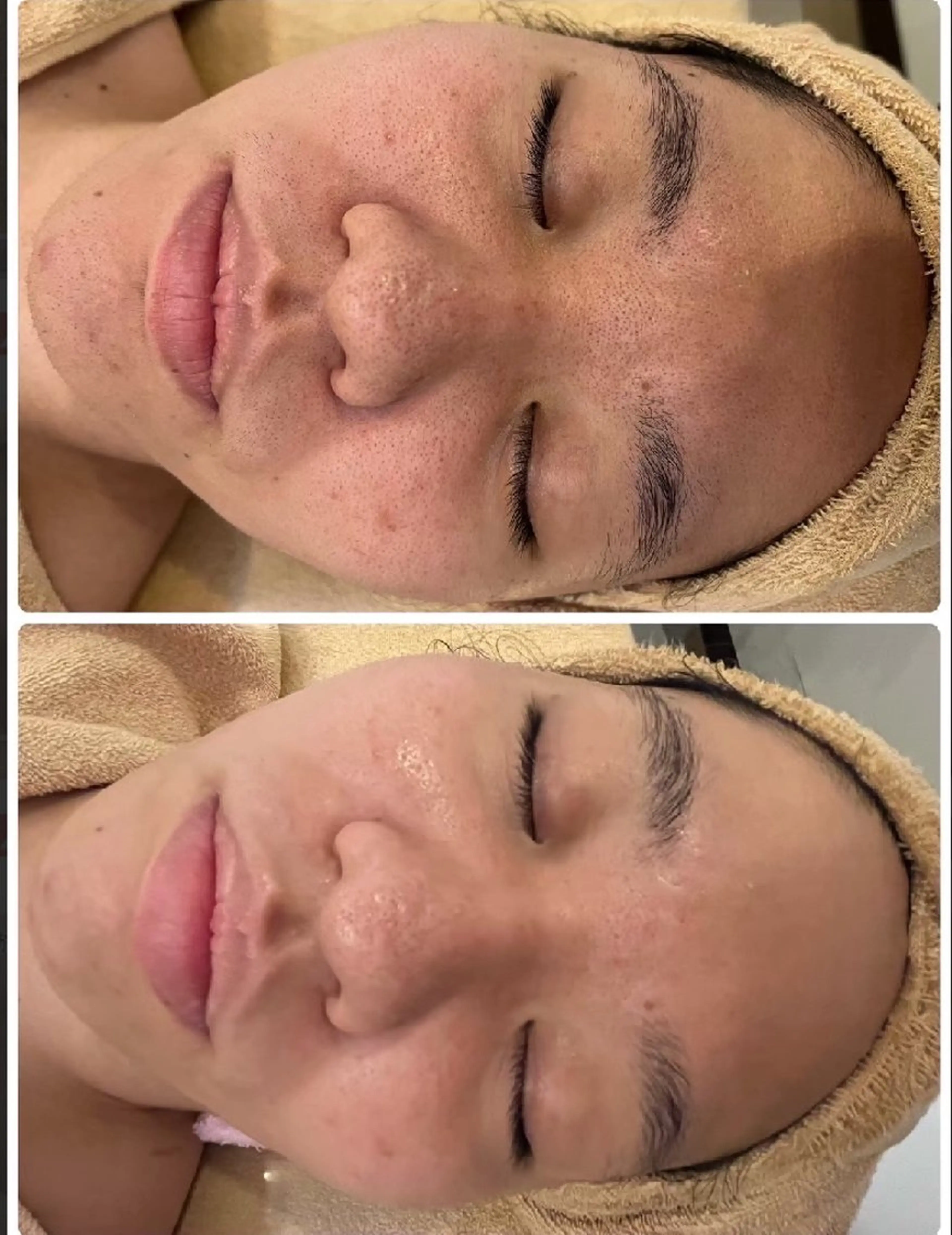 エステ LOUISE. ／脱毛のエステ・リラクイメージ