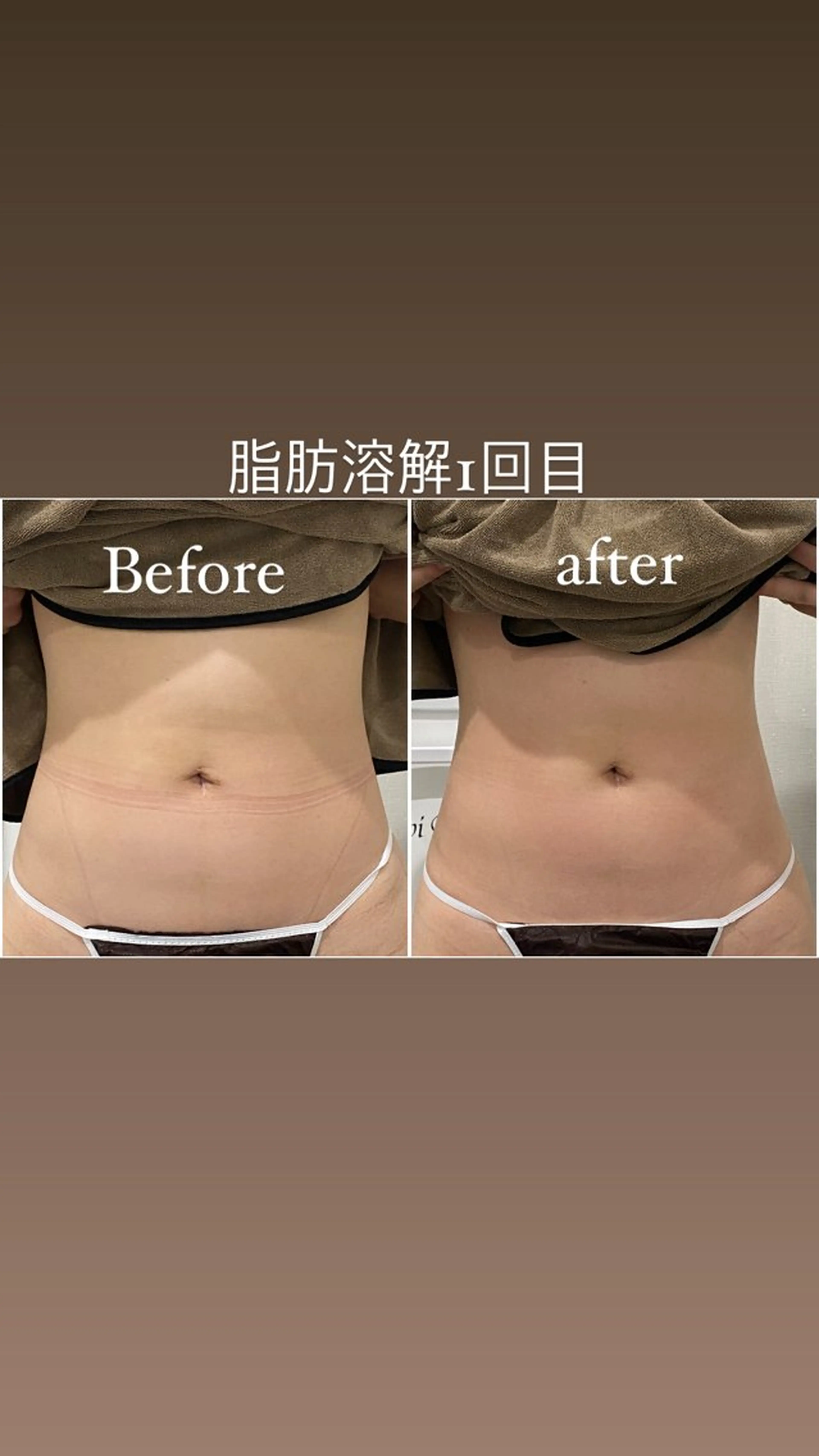 エステ 毛穴洗浄・痩身・脱毛 /アルカンジュのエステ・リラクイメージ