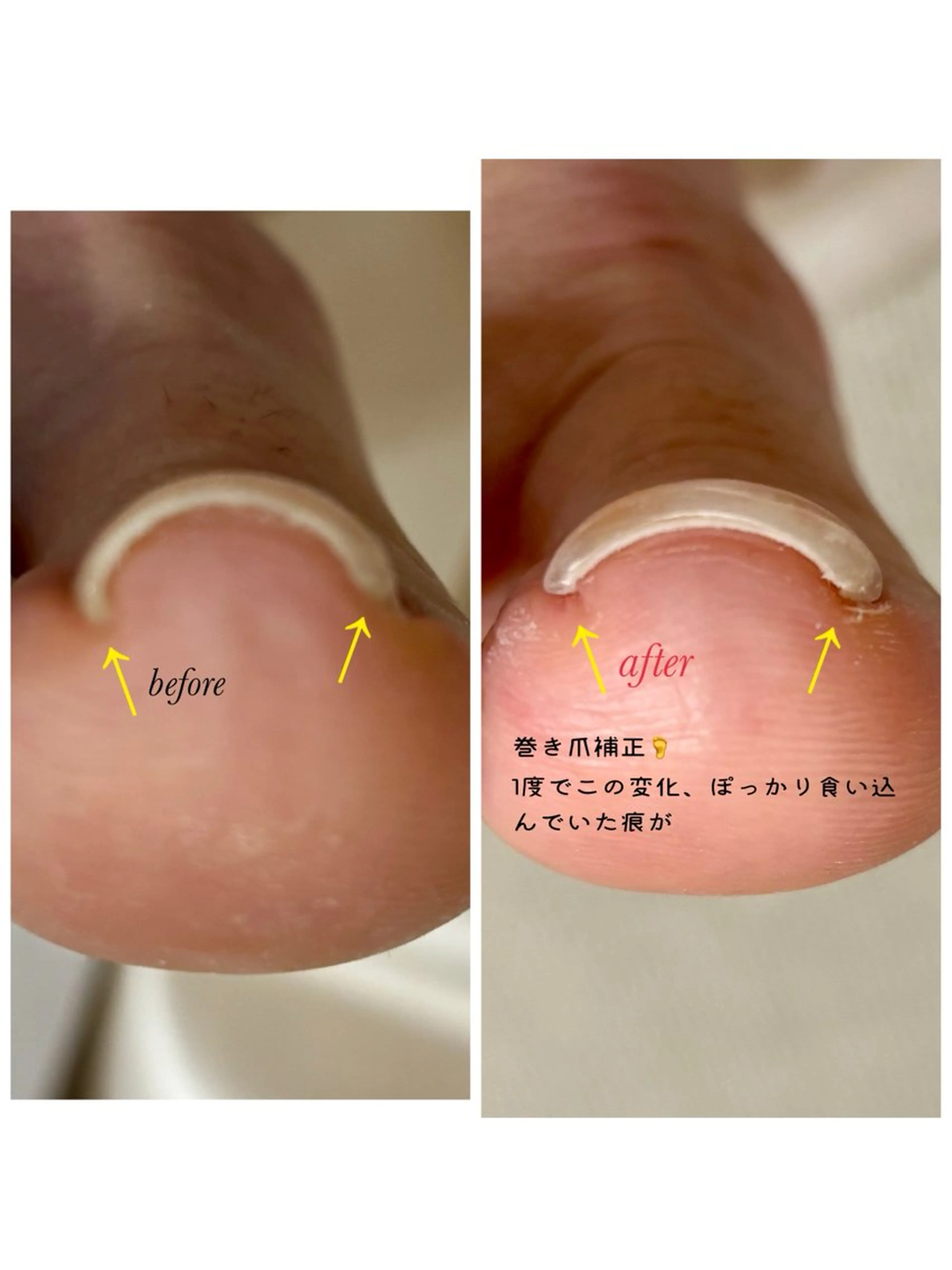 メンズ ネイル Chérinail 爪のお手入れのネイルデザイン