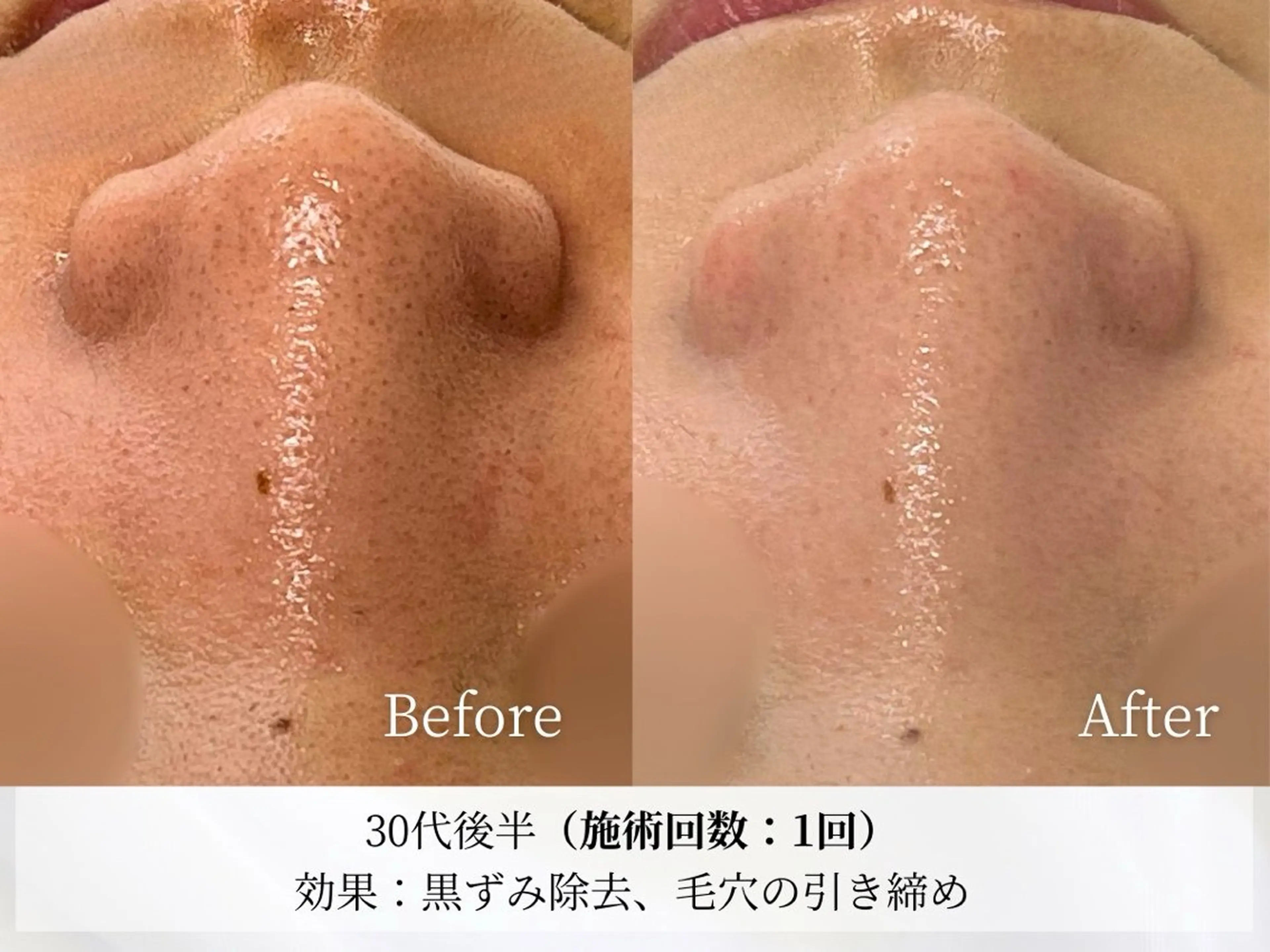 その他 Astorie 相模大野エステのその他イメージ