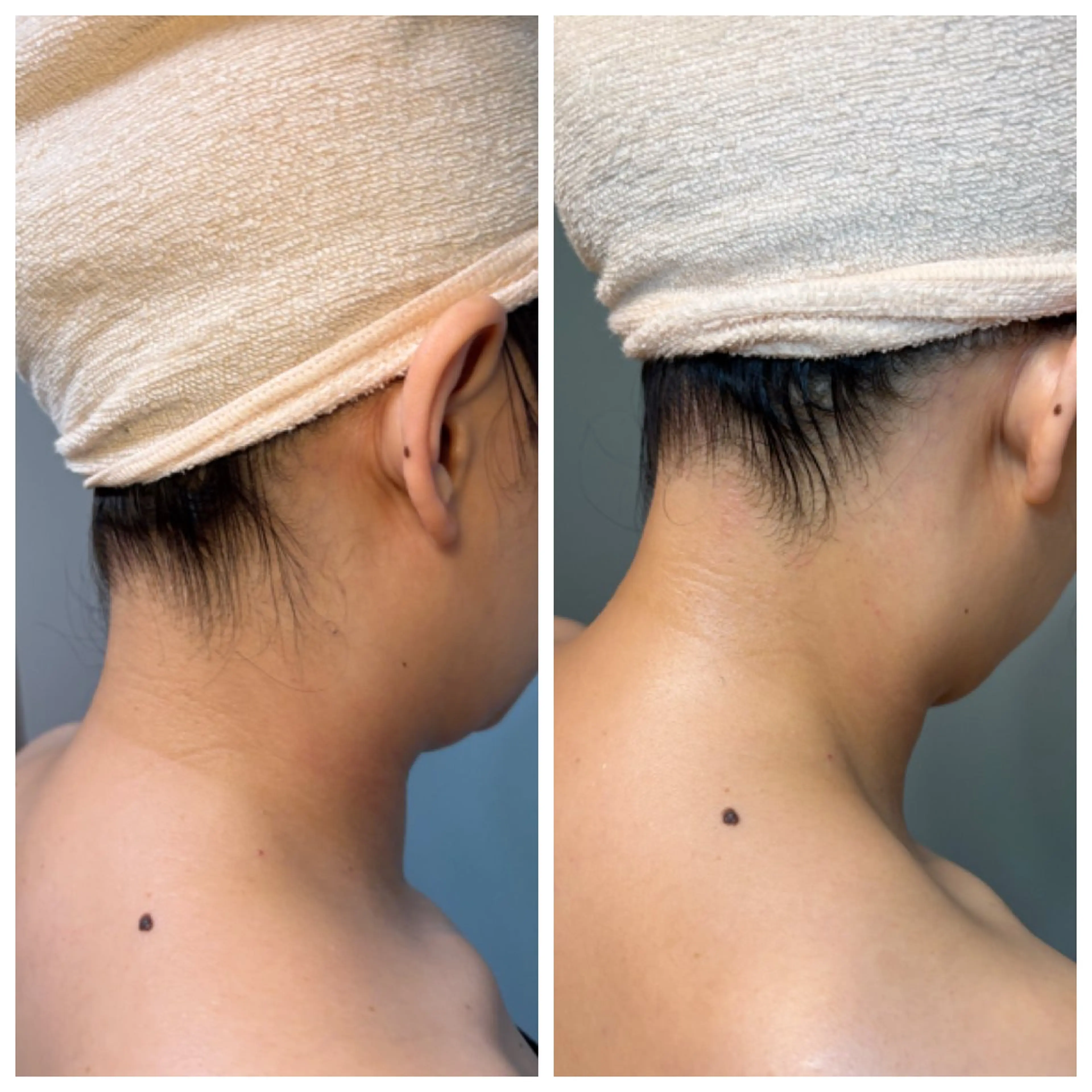 【ハーブピーリング】 Allumentのエステ・リラクイメージ