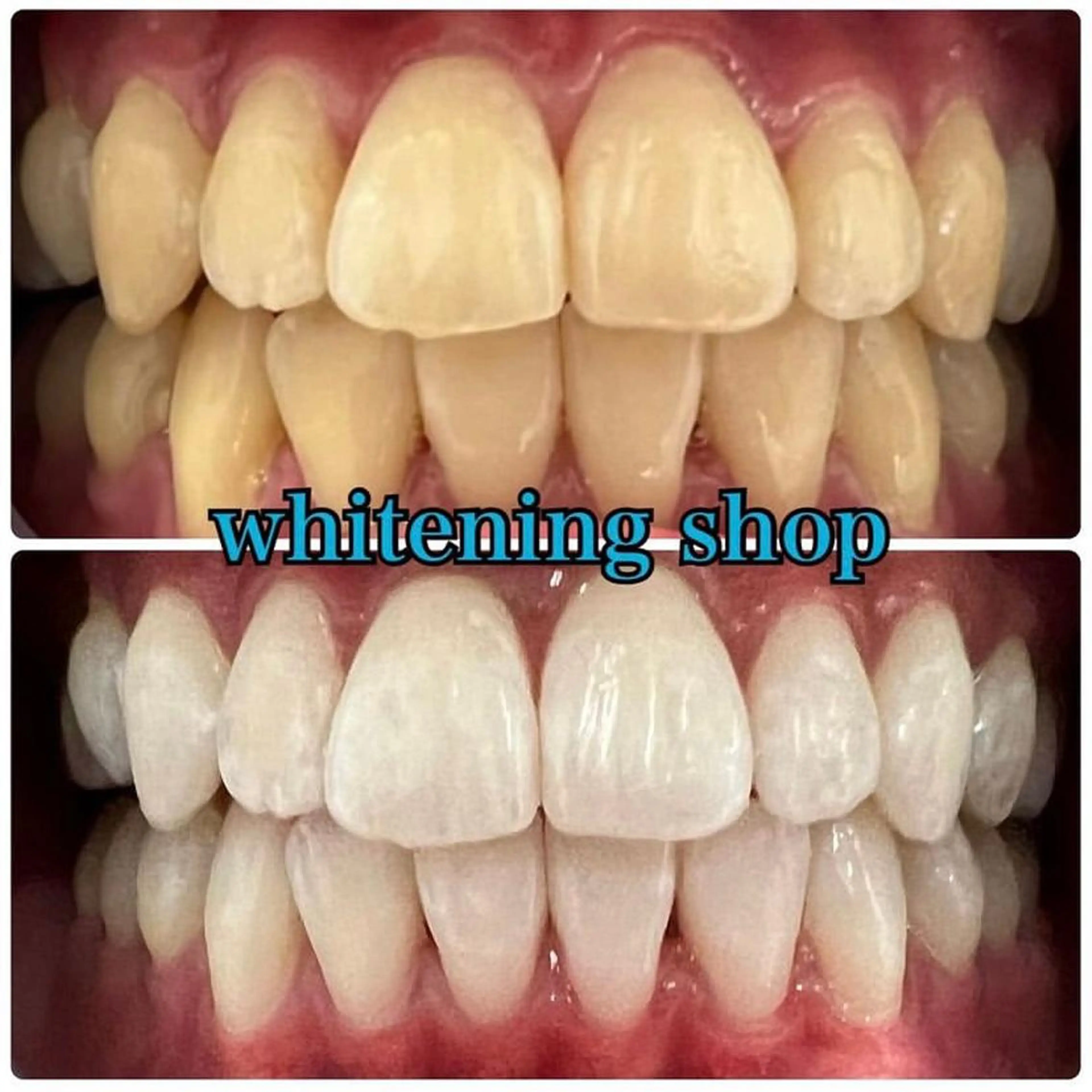 ホワイトニング ショップ吉祥寺店のエステ・リラクイメージ