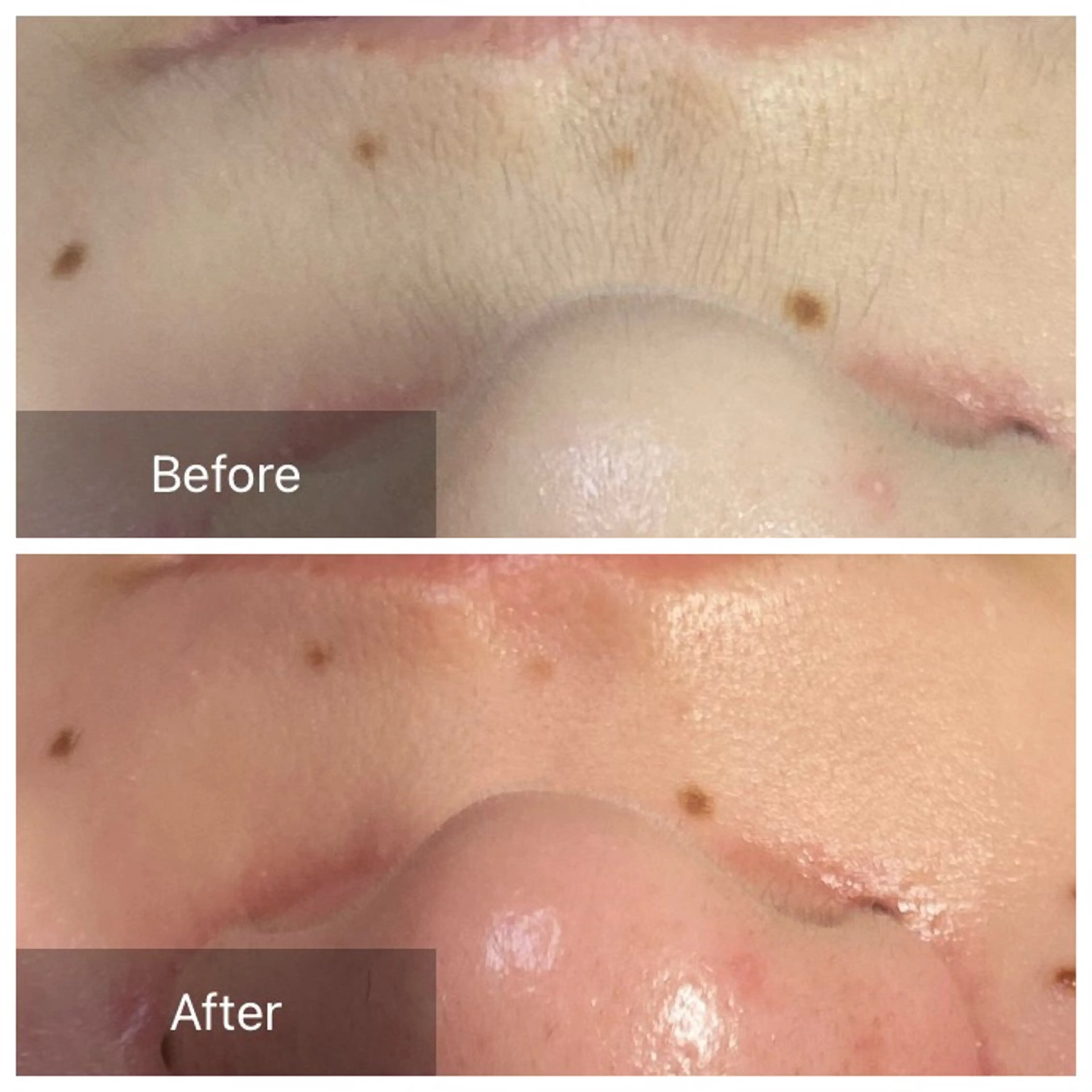 脱毛 産毛専門店 Bittoのエステ・リラクイメージ