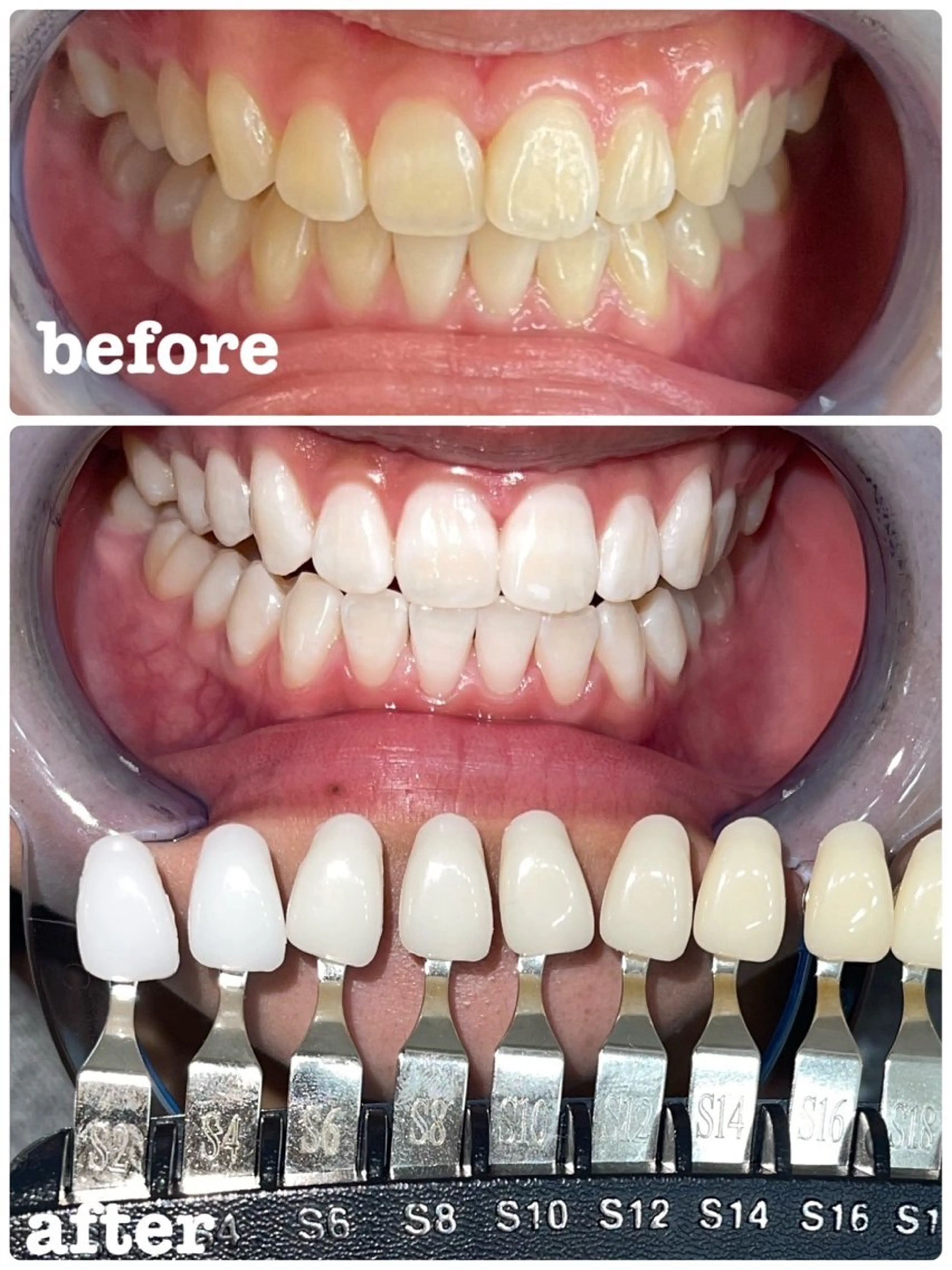 セルフホワイトニング エクシア徳島店マユのその他イメージ