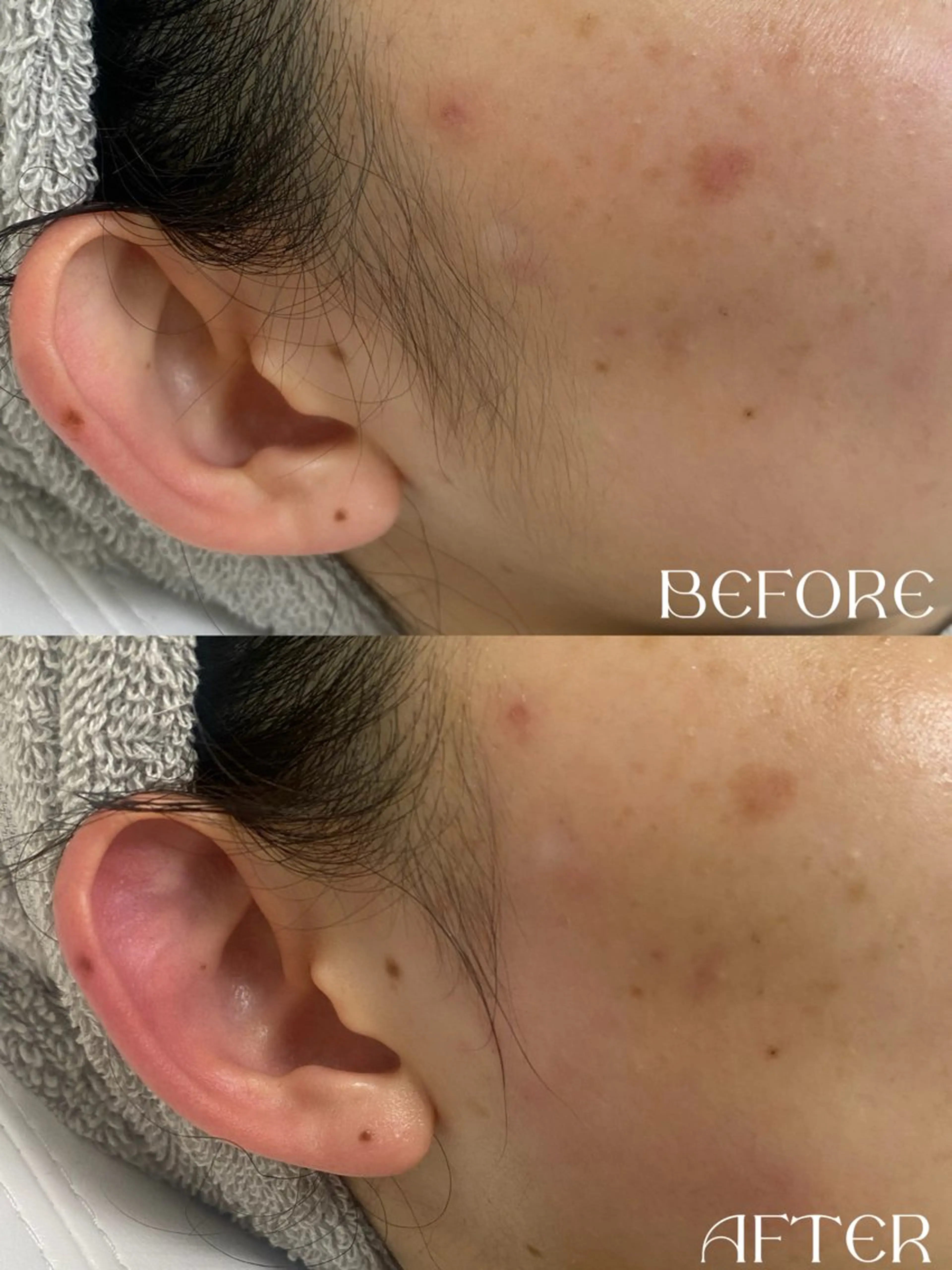 schön所属・schön 松井のエステ・リラクイメージ