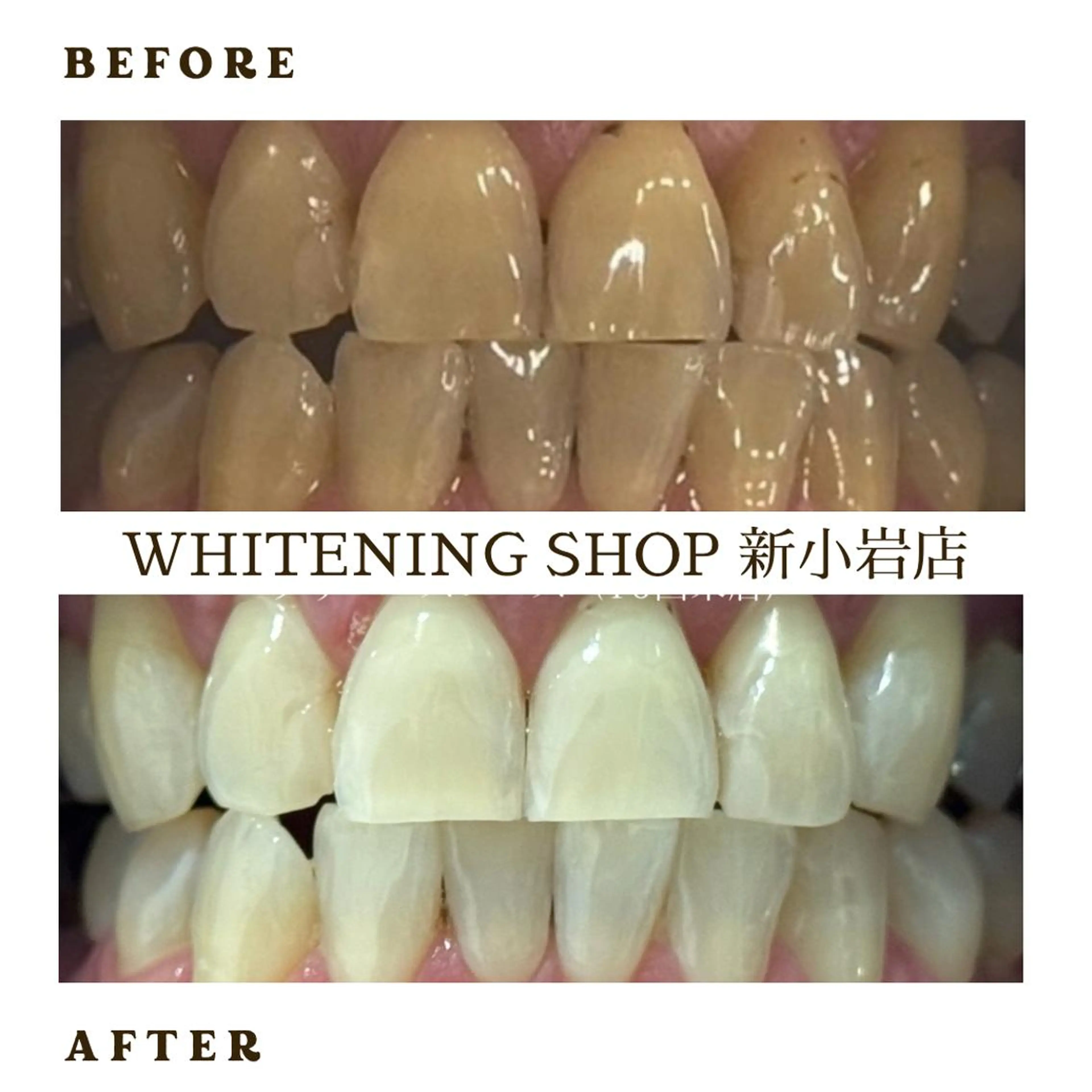 メンズ ホワイトニング ショップ新小岩店のその他イメージ