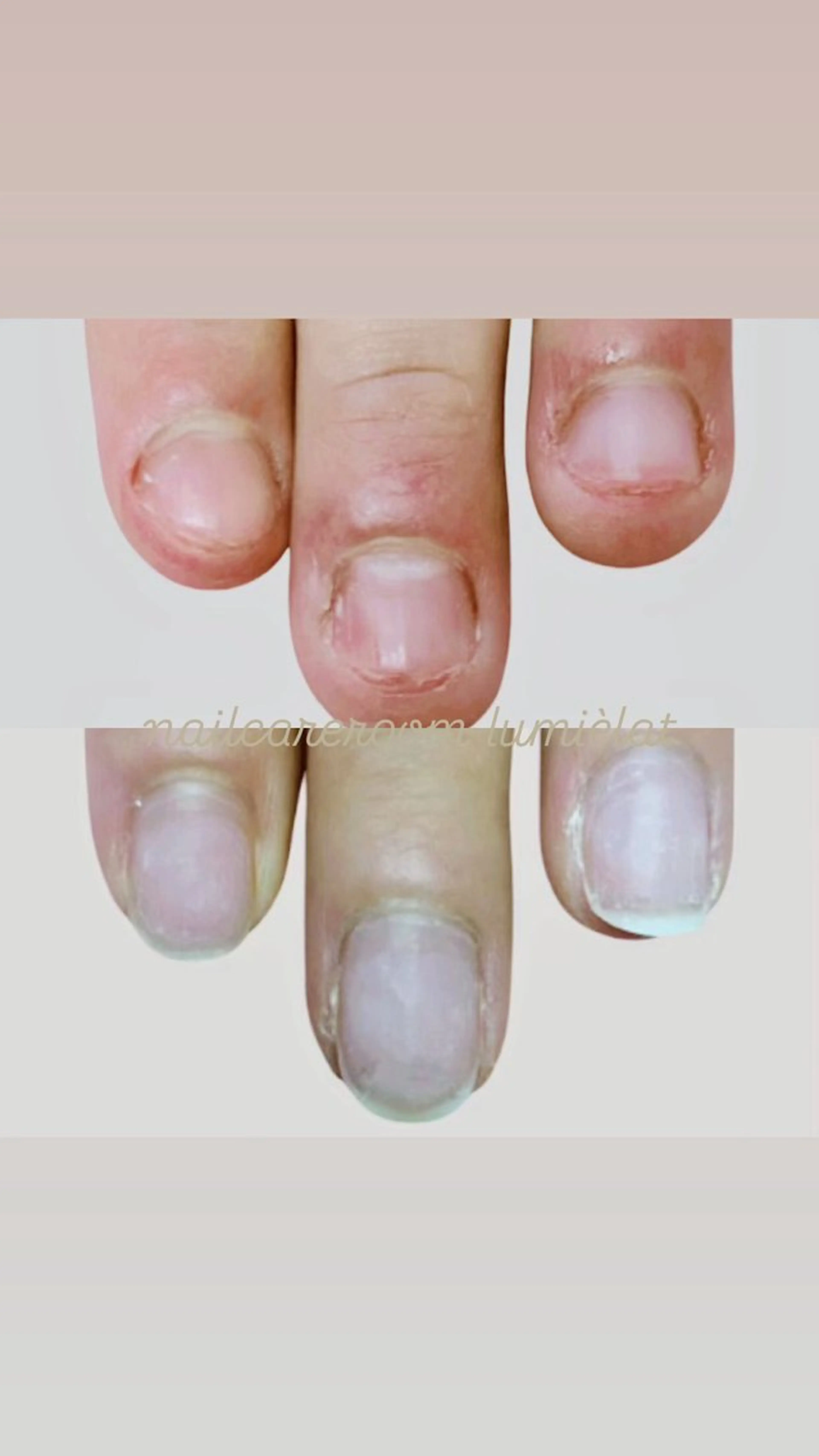 ネイル 深爪育成専門nail _Lumièlatのネイルデザイン