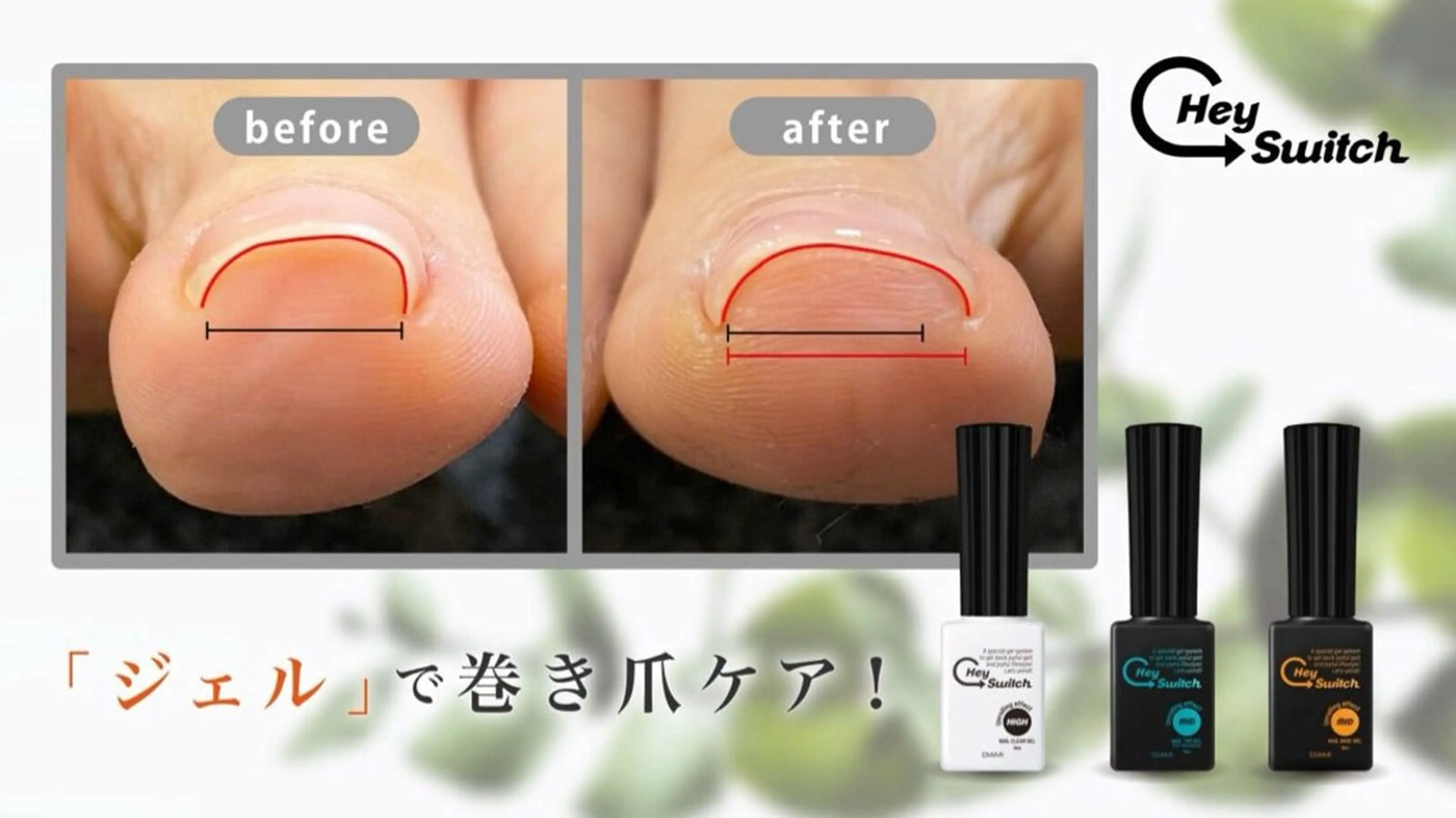 巻き爪ケアモニター募集！👣痛くない施術で2回通える方限定✨の写真