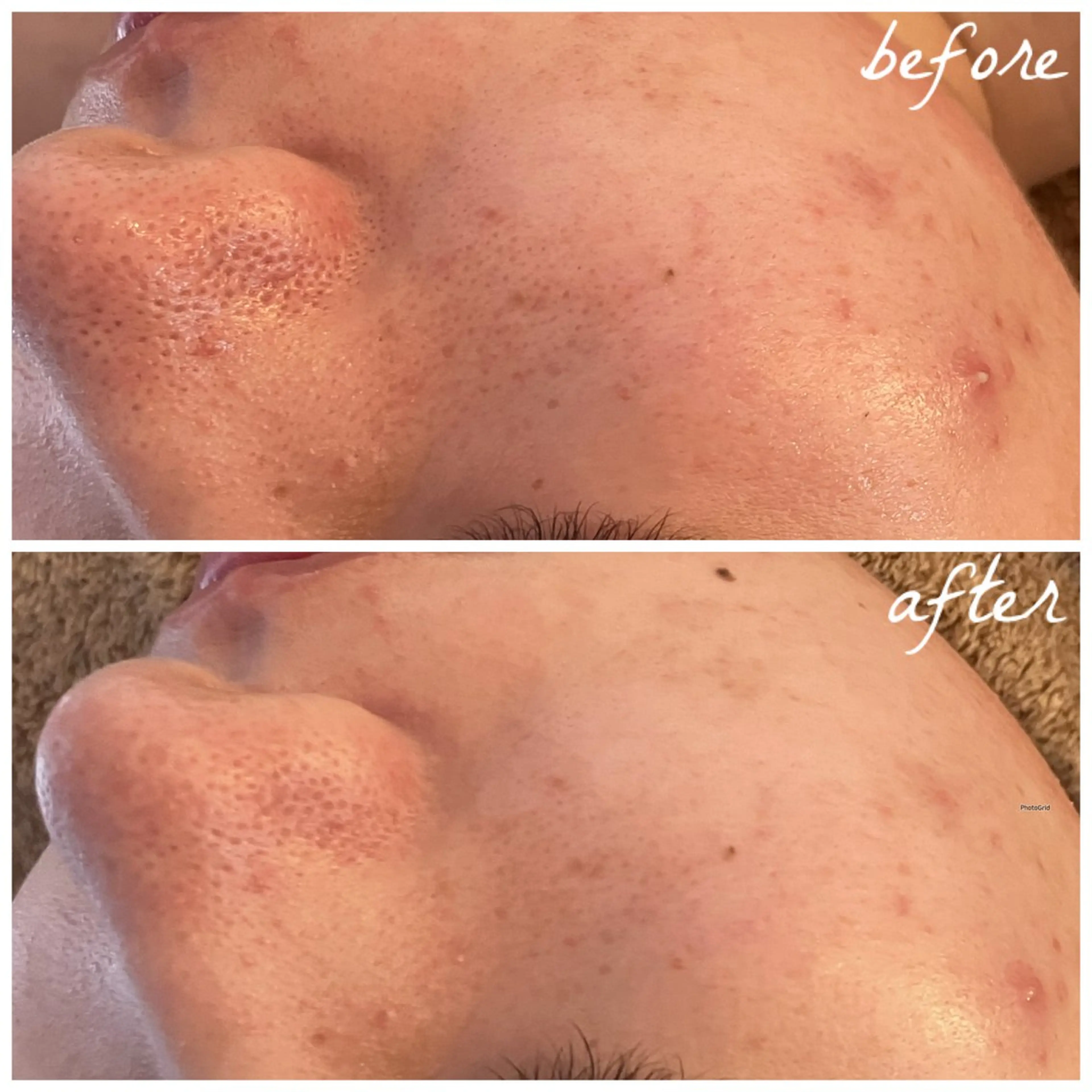 メンズ メナード岐阜茜部 杉浦のエステ・リラクイメージ