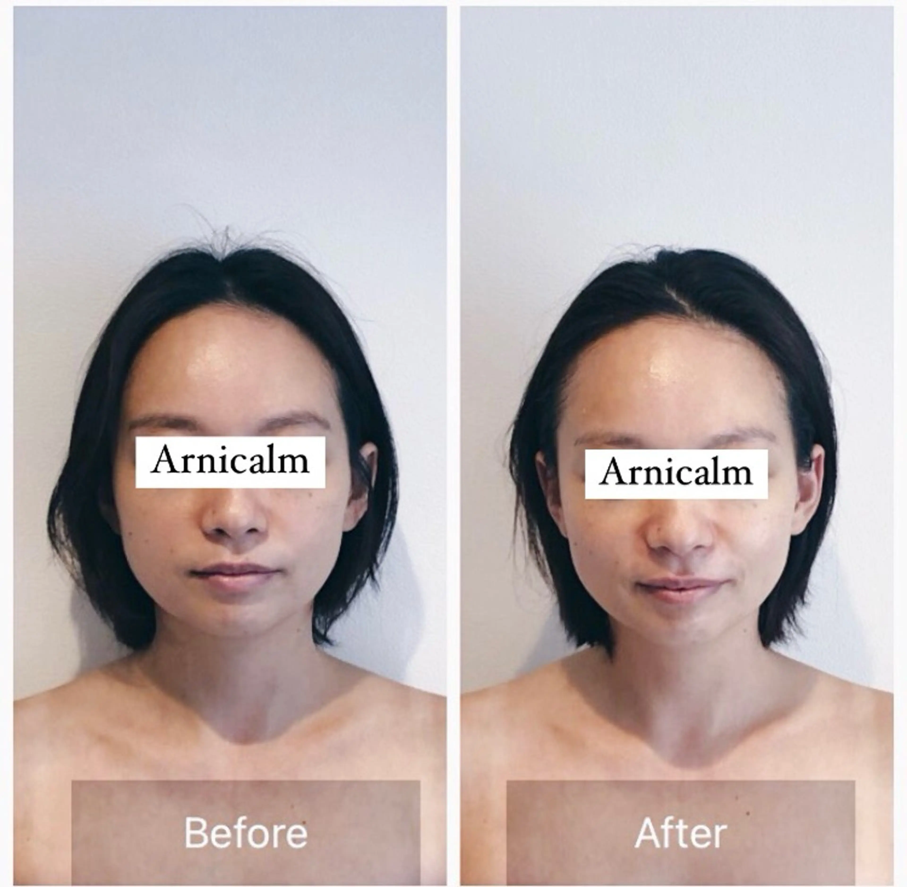 ハーブピーリング 肌再生ピーリング/のエステ・リラクイメージ