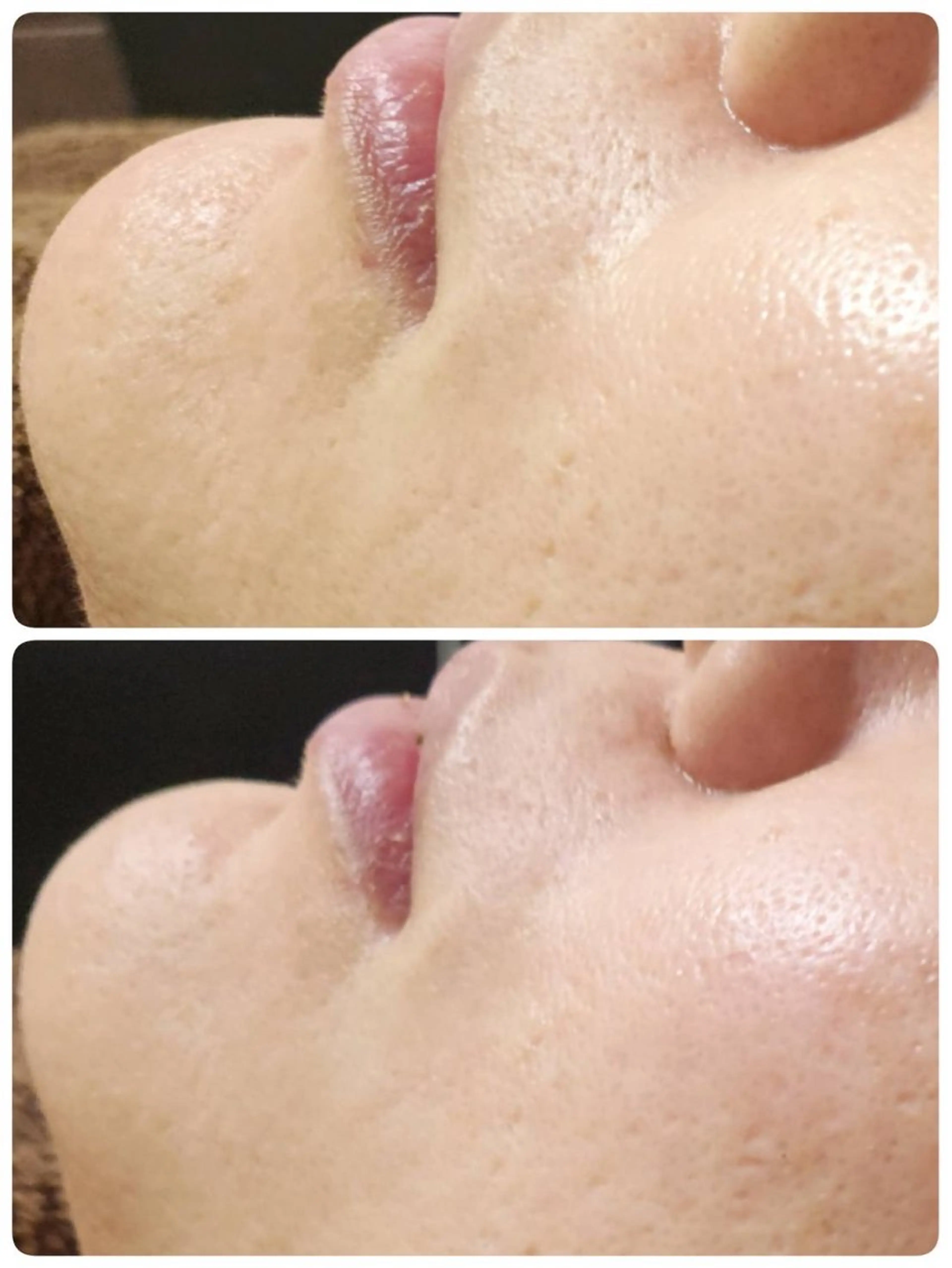 その他 Astorie 相模大野エステのその他イメージ