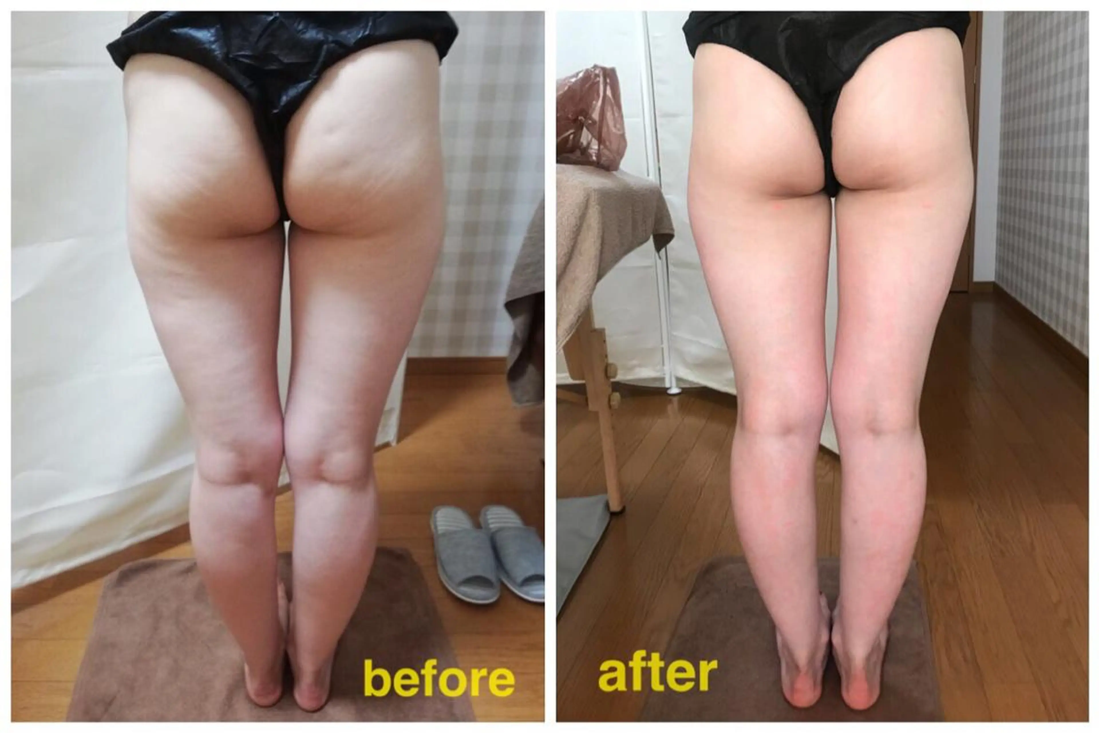 《本気痩せ×疲労改善 》  BILOOPのエステ・リラクイメージ