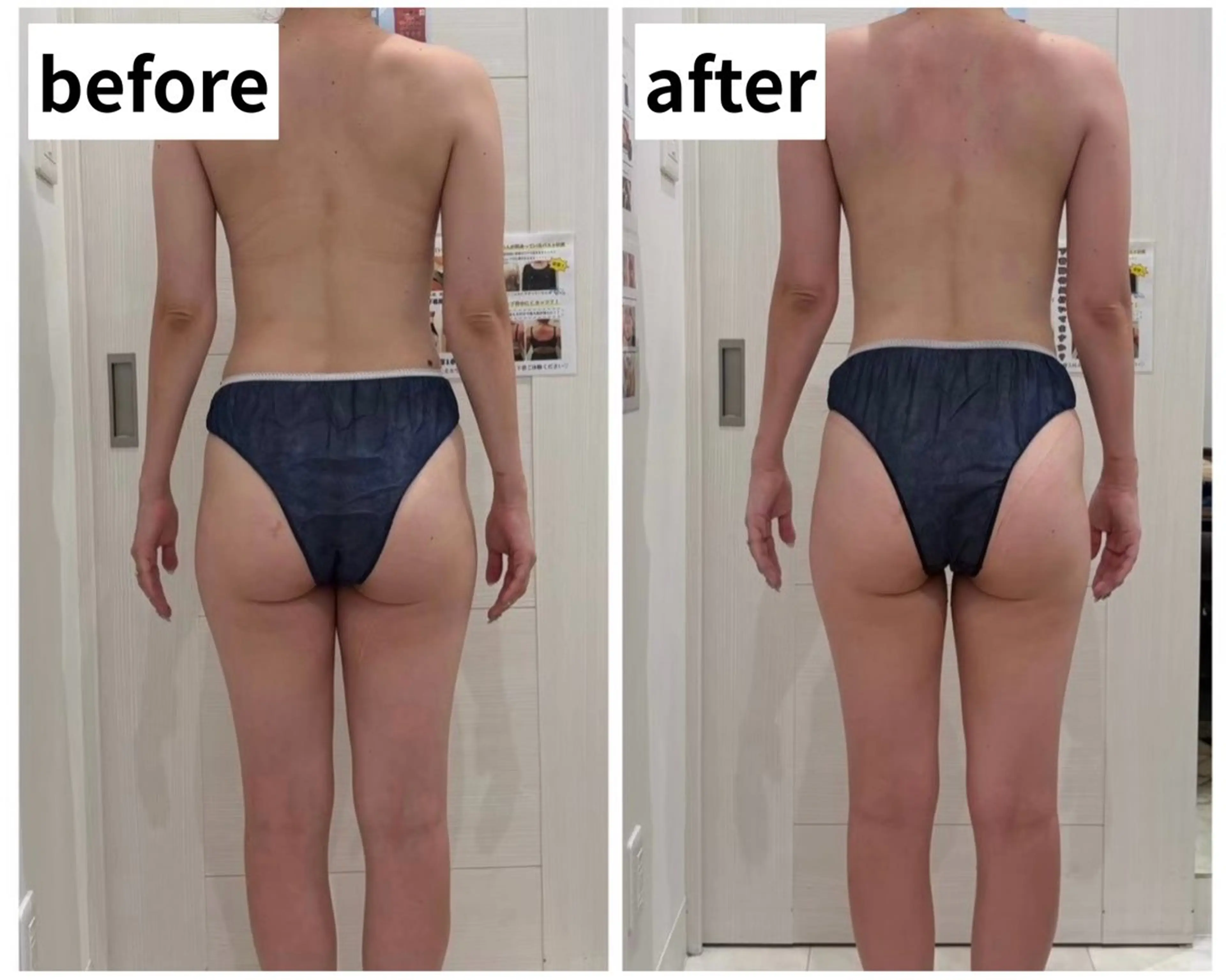 滝汗専門店 女神デトックス仙台店のエステ・リラクイメージ