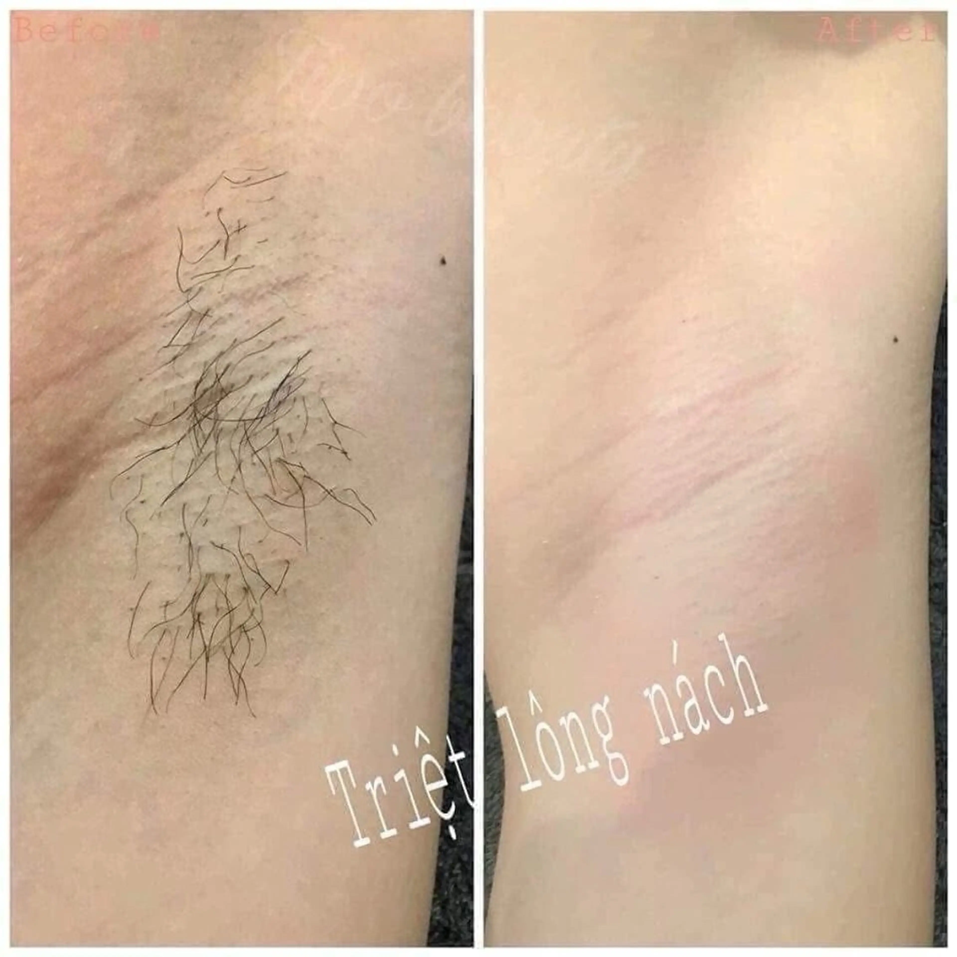 Thu Huyen Beauty所属・トウ フェンのエステ・リラクイメージ