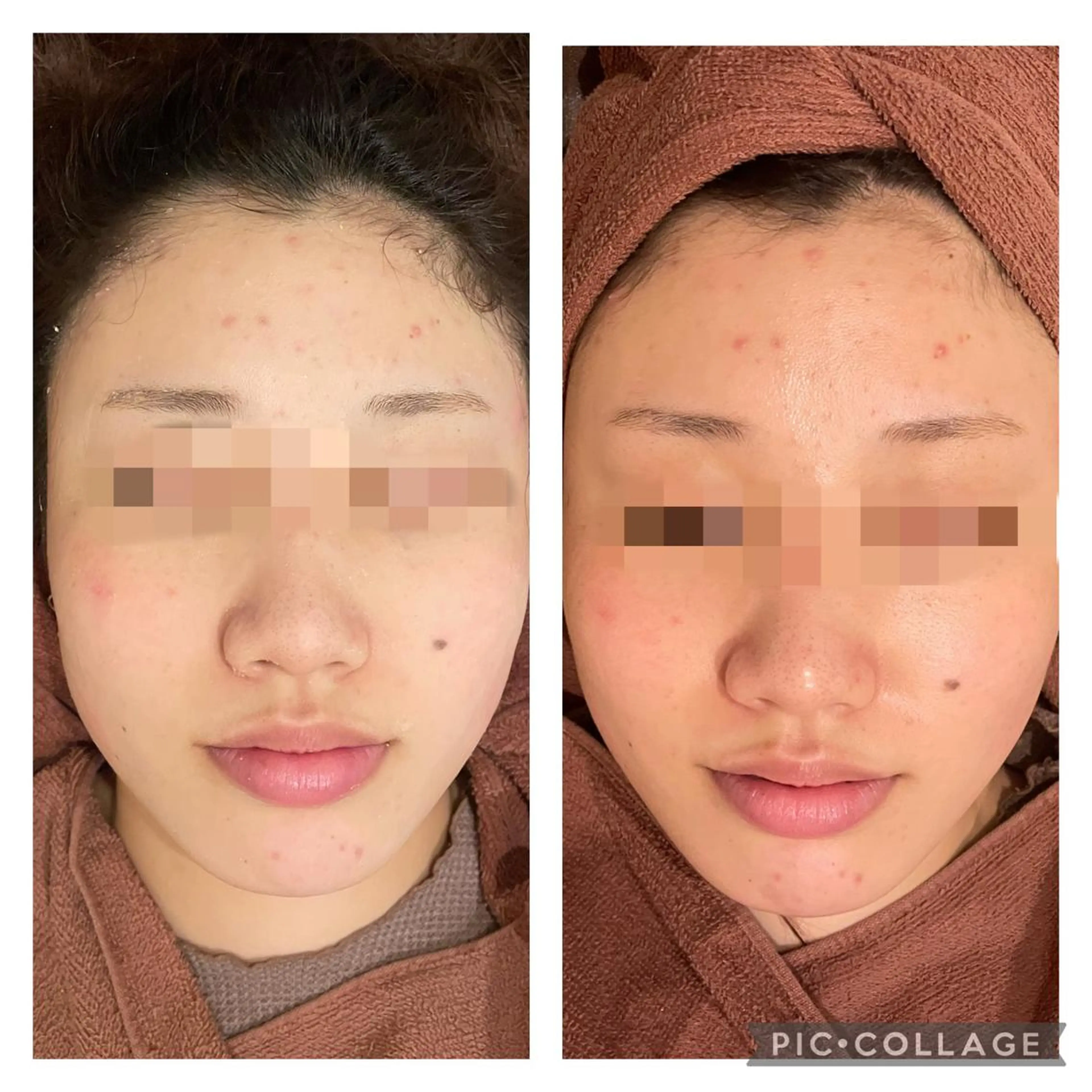 セミロング カラー パーマ ヘアアレンジ メンズ キッズ ネイル マツエク・マツパ アイブロウ エステ リラク ニキビ特化型エステ 🍋最短で肌質改善のエステ・リラクイメージ