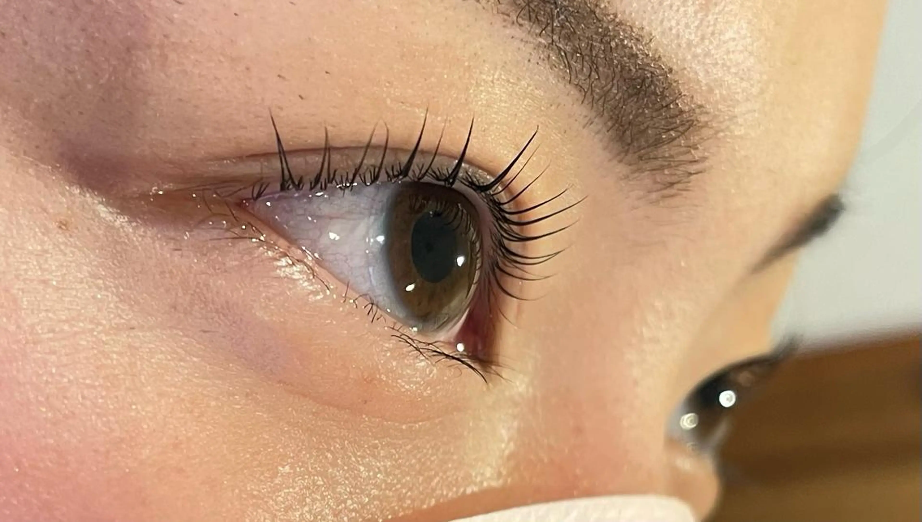 新規限定20%OFF‼︎美容液フルコースの写真