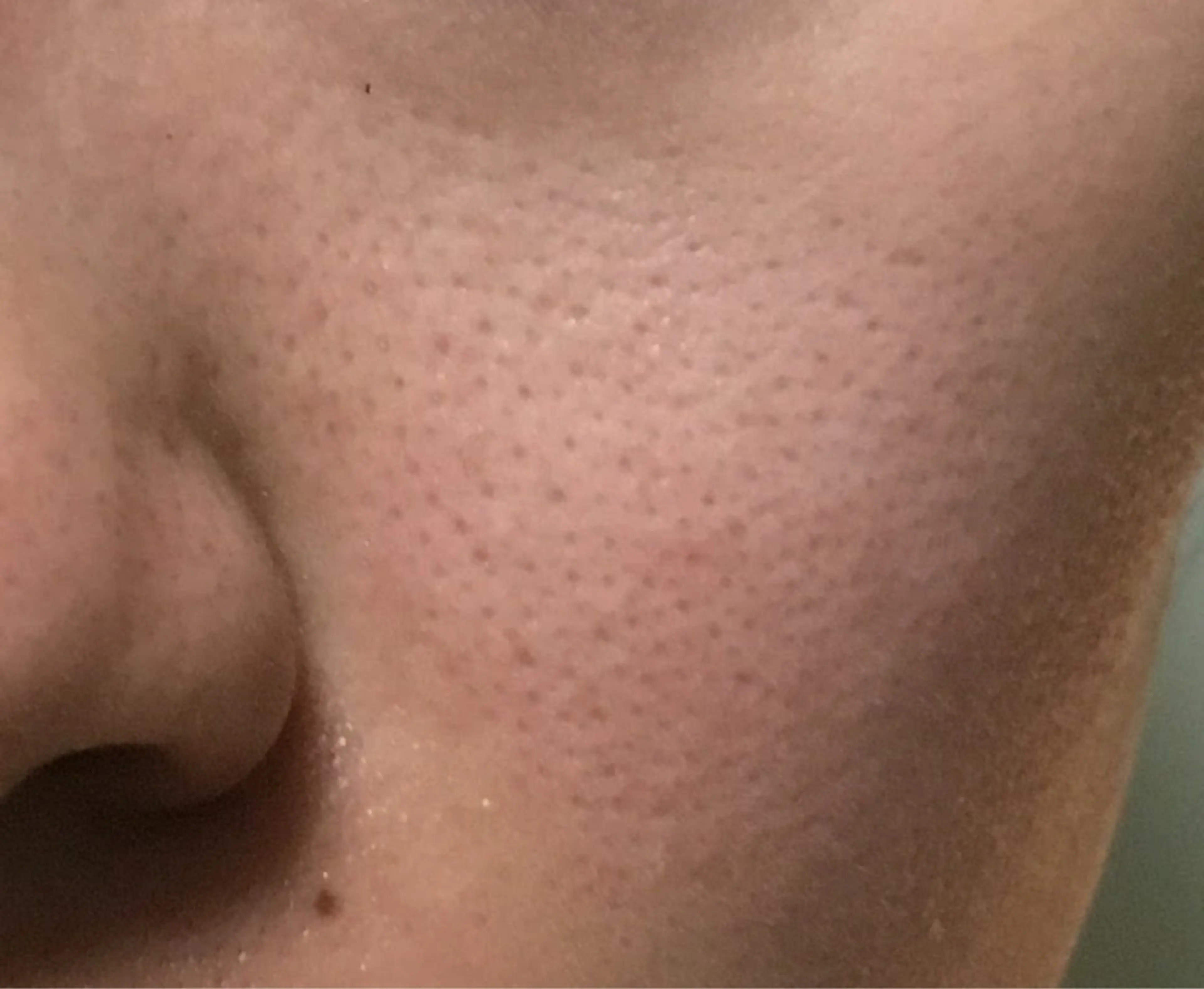 強圧デトックスリンパ 育菌専門店のその他イメージ