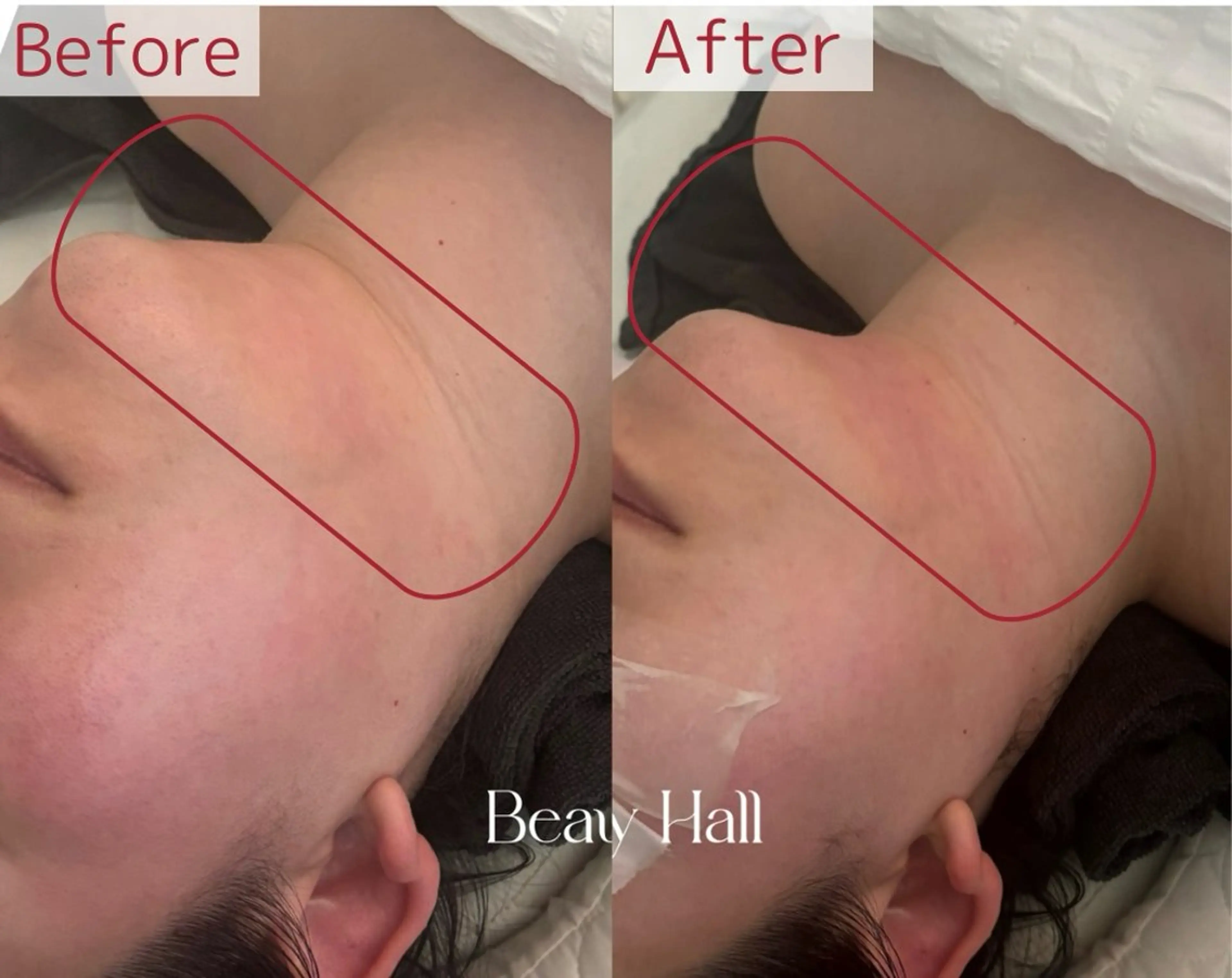 lumi riseのエステ・リラクイメージ