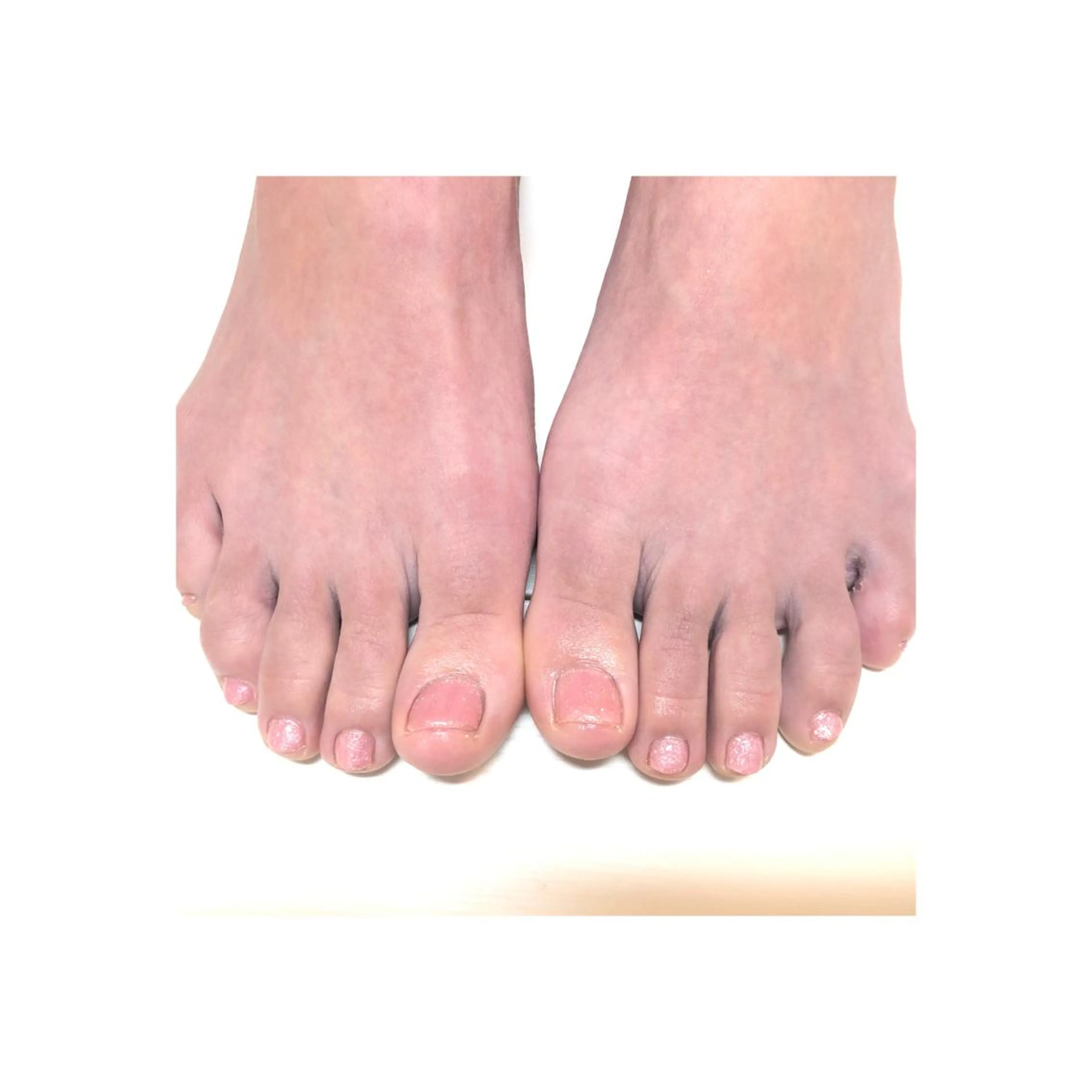 ネイル GDS NAIL はるのネイルデザイン