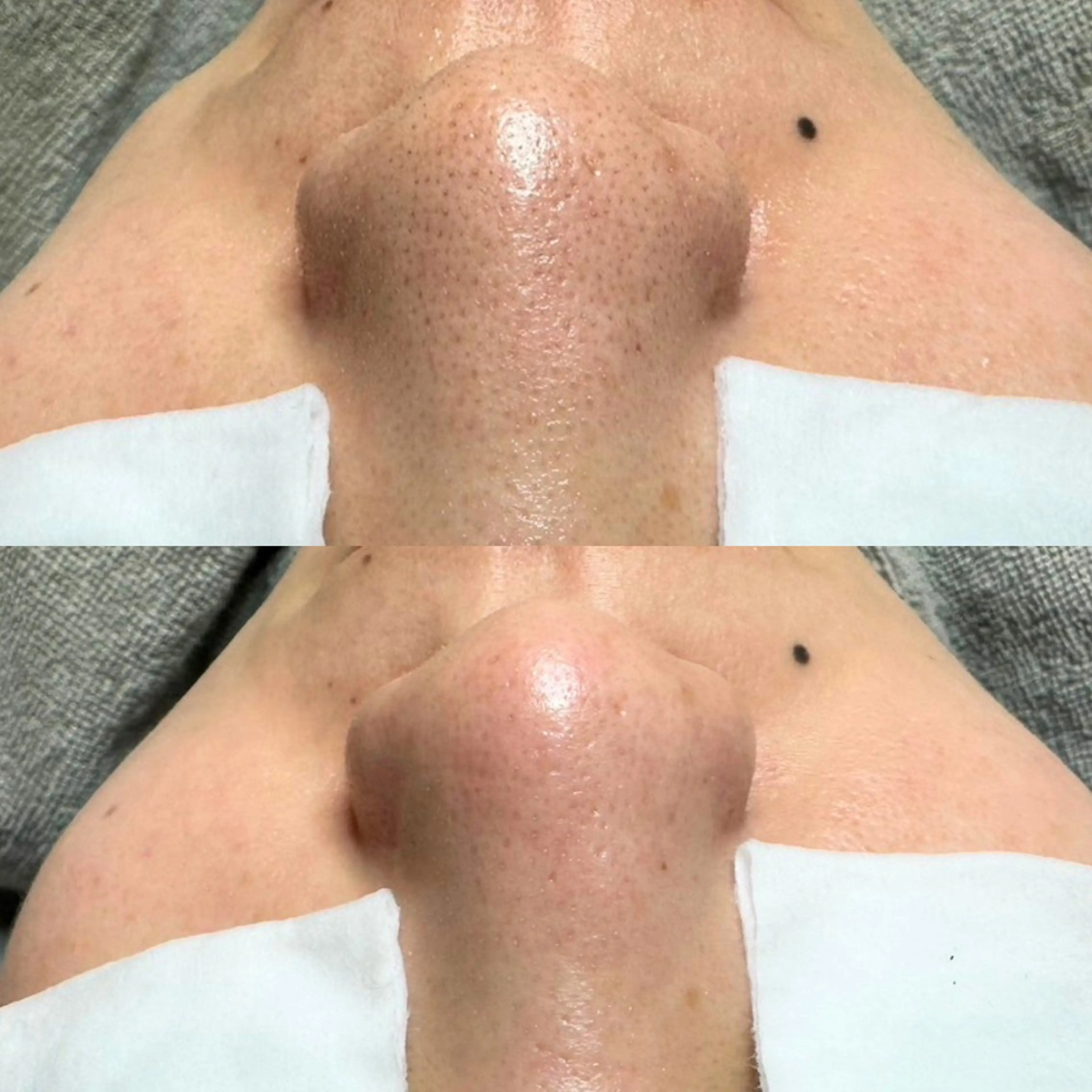 エステ 毛穴ケア特化専門店 トネア自由が丘店のエステ・リラクイメージ