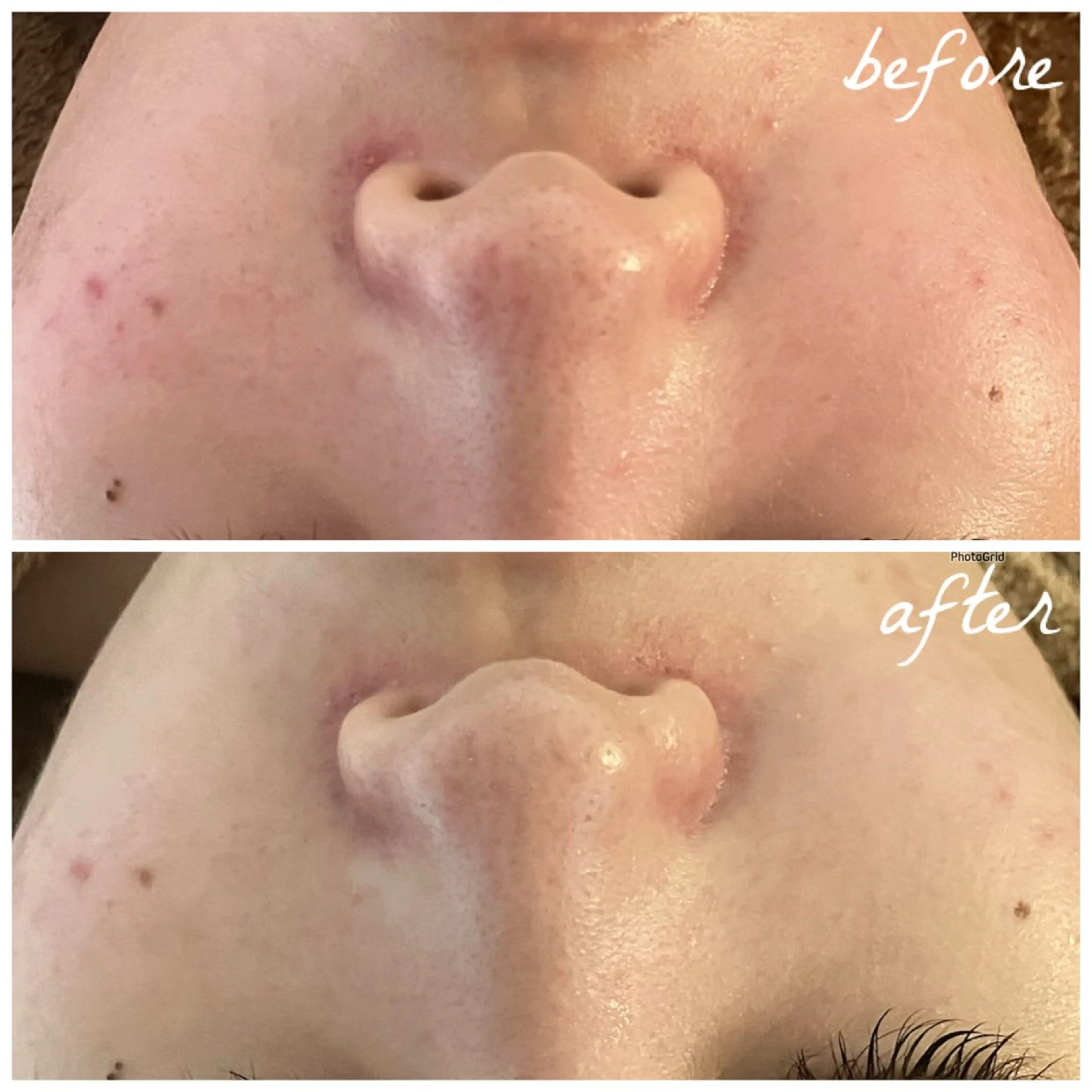 メンズ エステ メナード岐阜茜部 杉浦のエステ・リラクイメージ