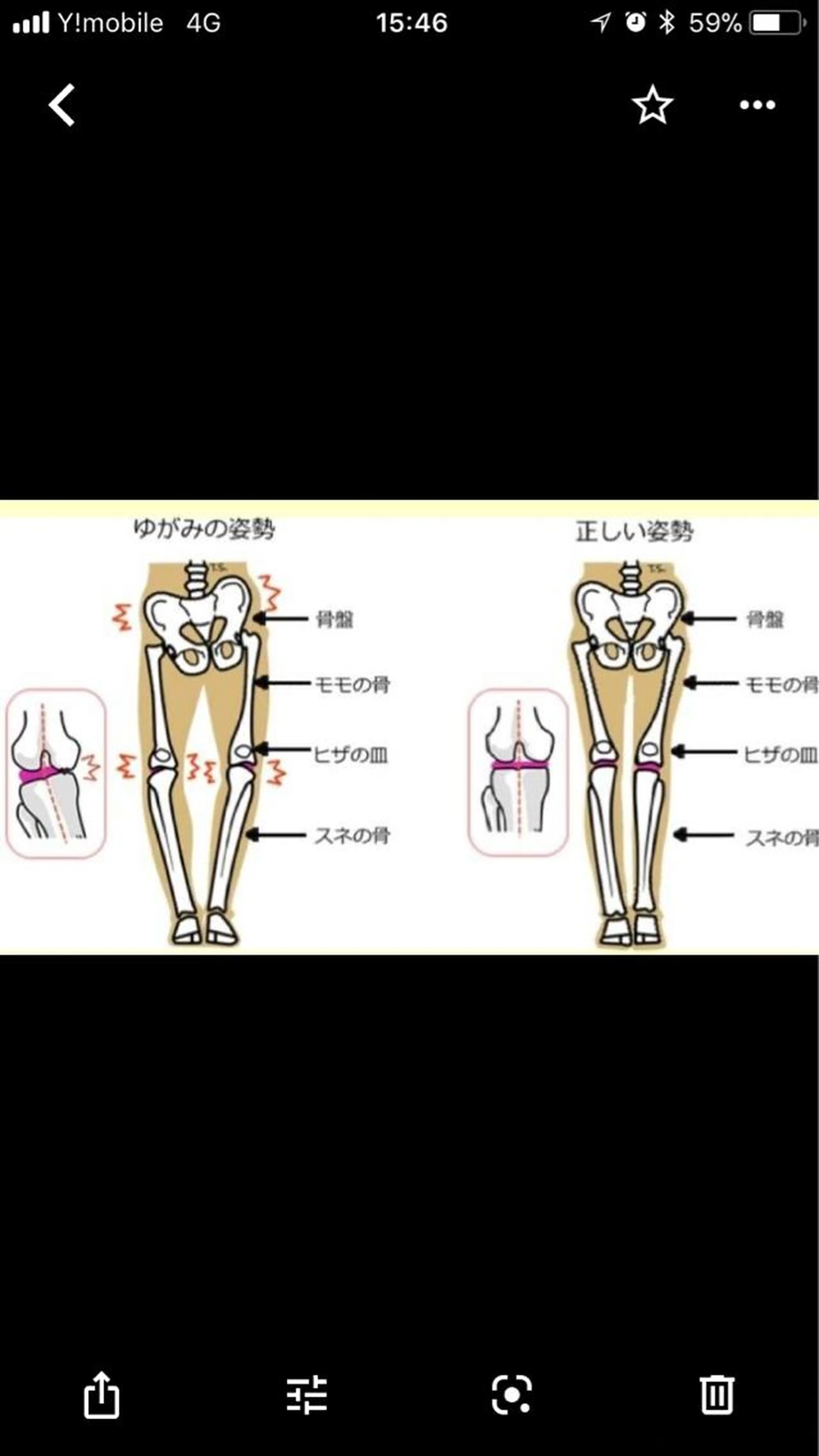 骨盤調整➕運動体験の写真
