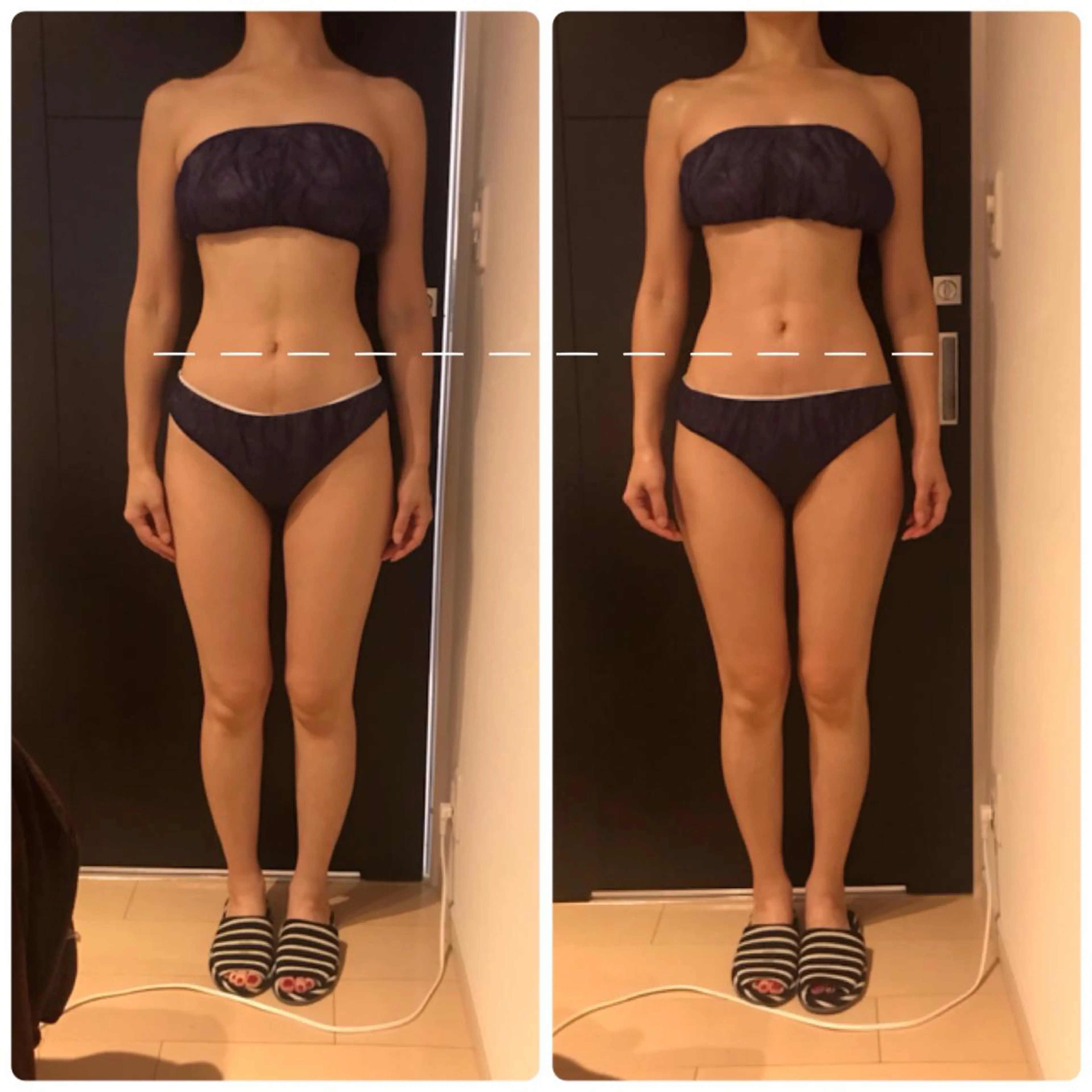 調律エステ /美KISSのその他イメージ