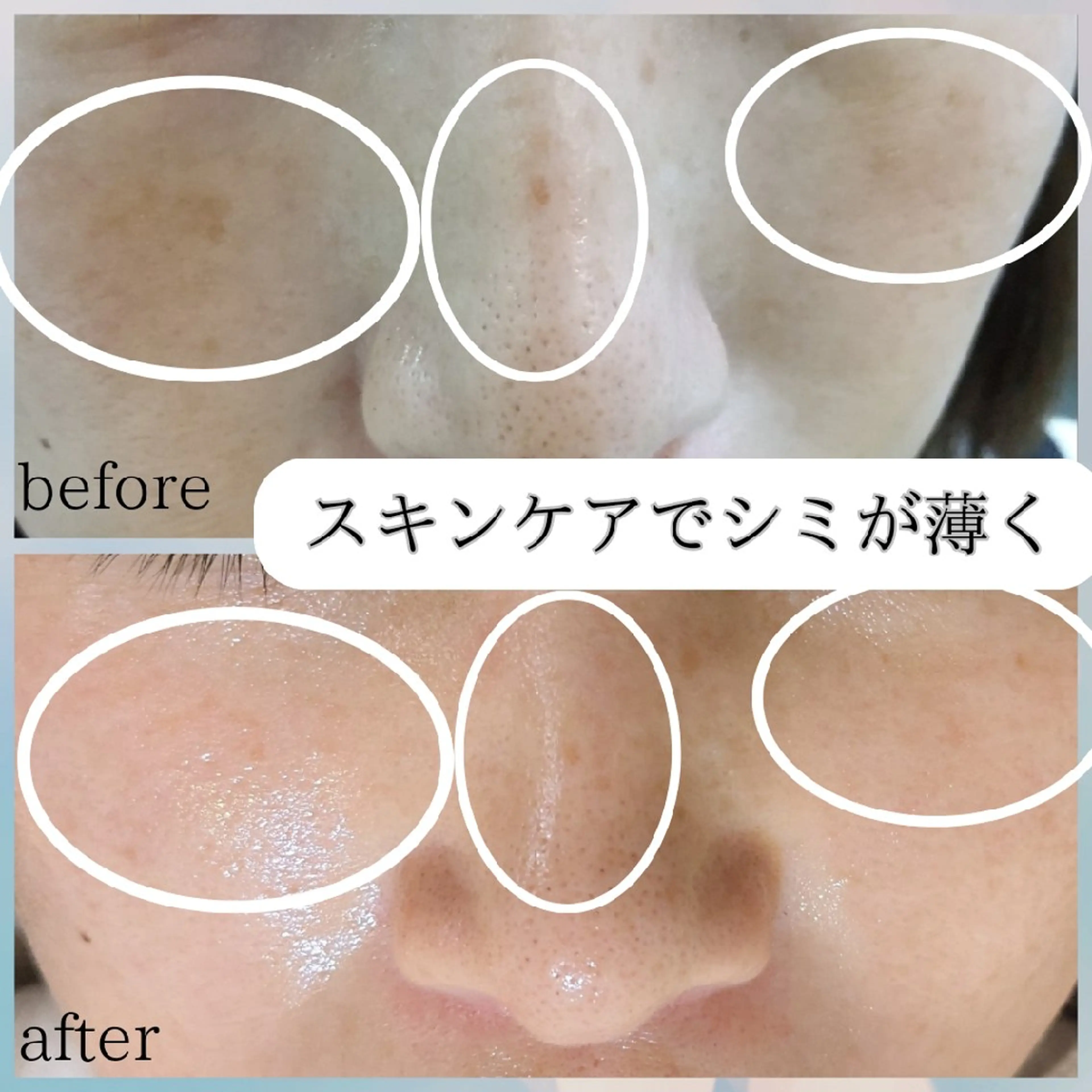 フェイシャル/毛穴 /シミ/たるみ東灘区のエステ・リラクイメージ