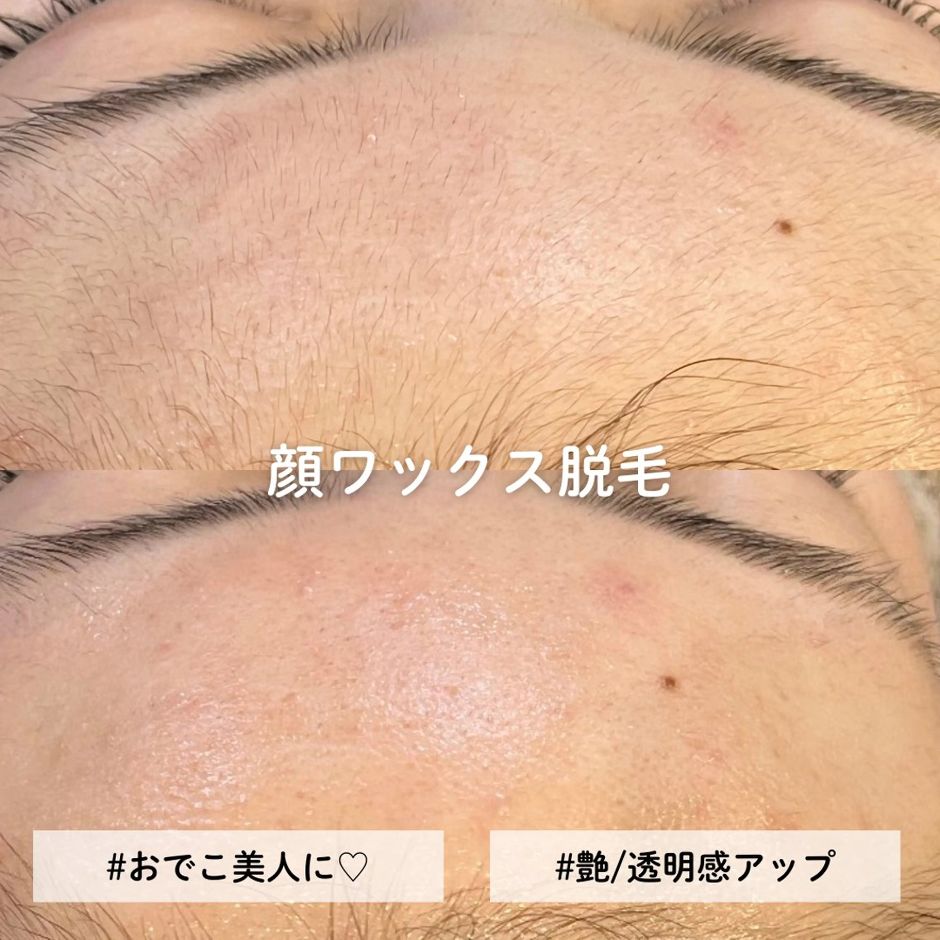 顔ワックス脱毛/ ハーブピーリングのエステ・リラクイメージ