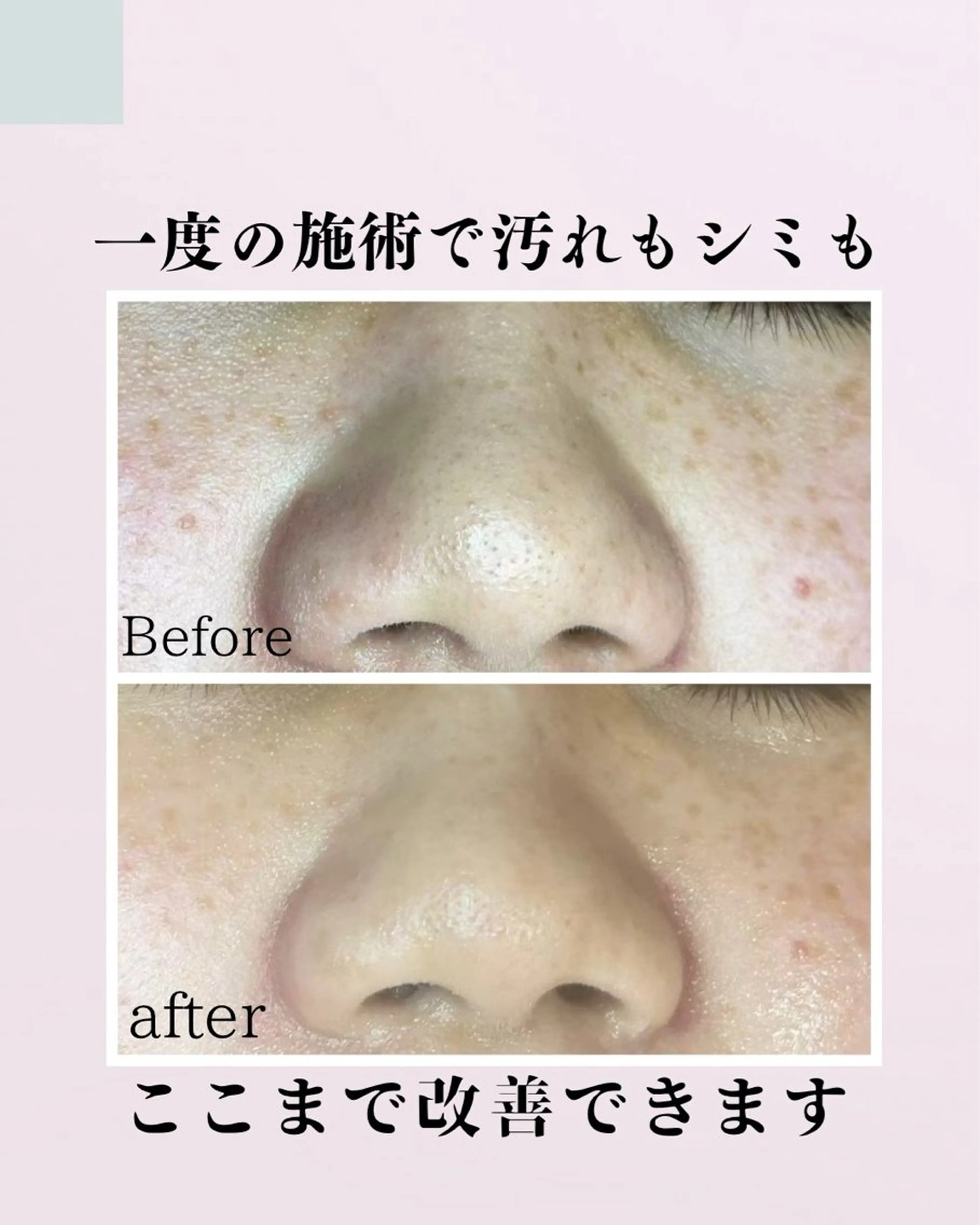 エステ リラク 肌質改善サロン facialmoonのエステ・リラクイメージ