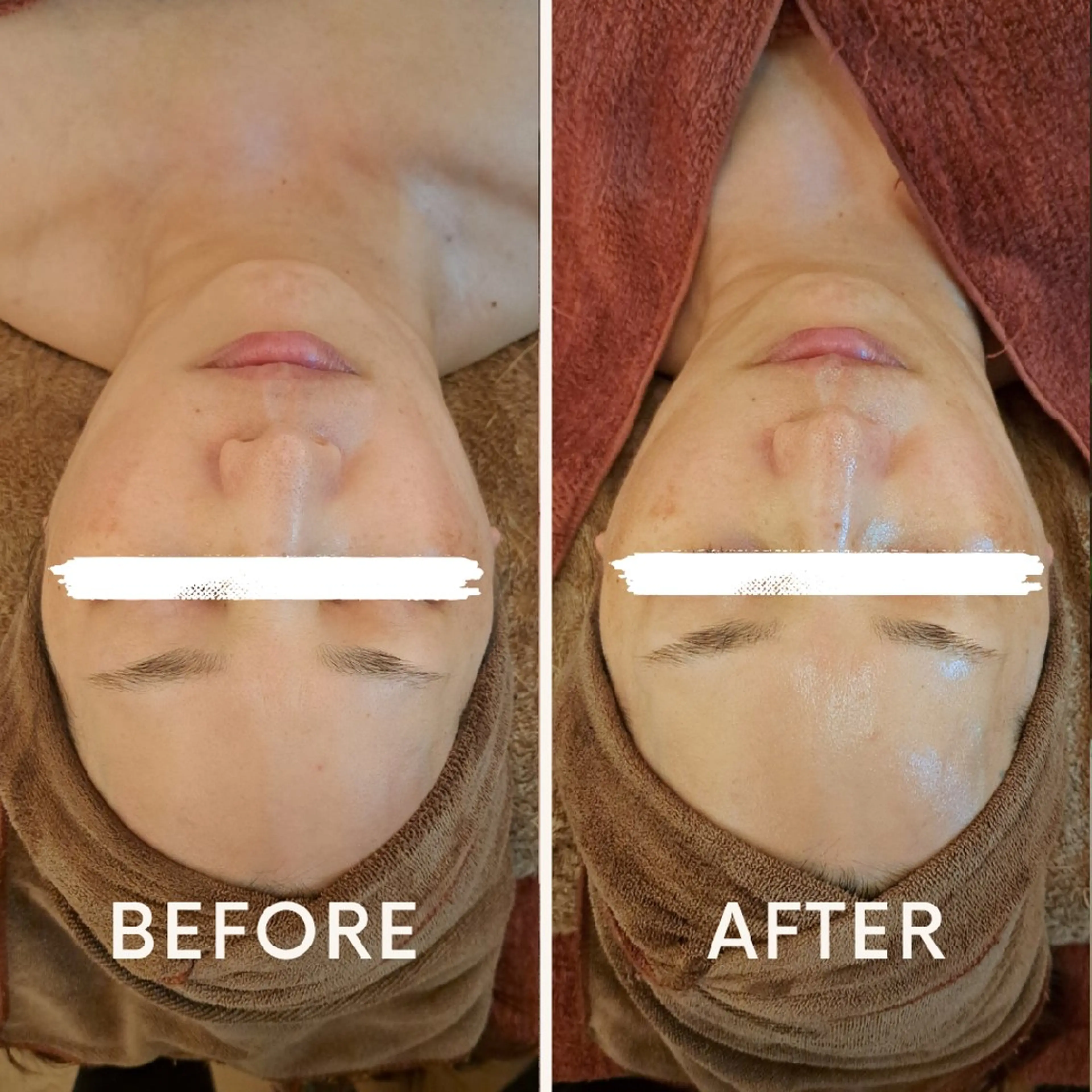 エステ リラク 鍼灸サロンmiyabi所属・美容鍼×エステ　鍼灸 サロンmiyabiのエステ・リラクイメージ