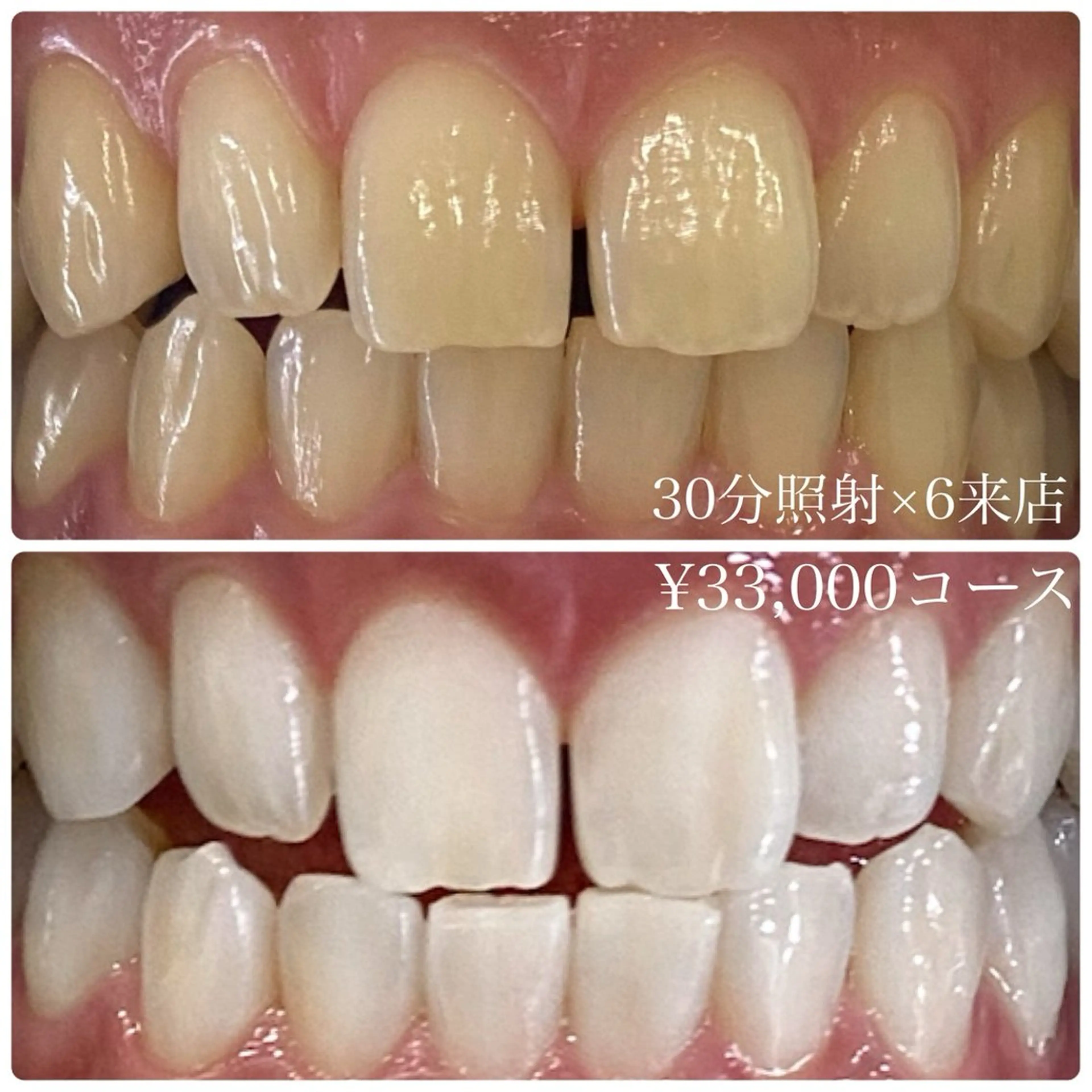 その他 ホワイトニングルーム 横浜店のその他イメージ