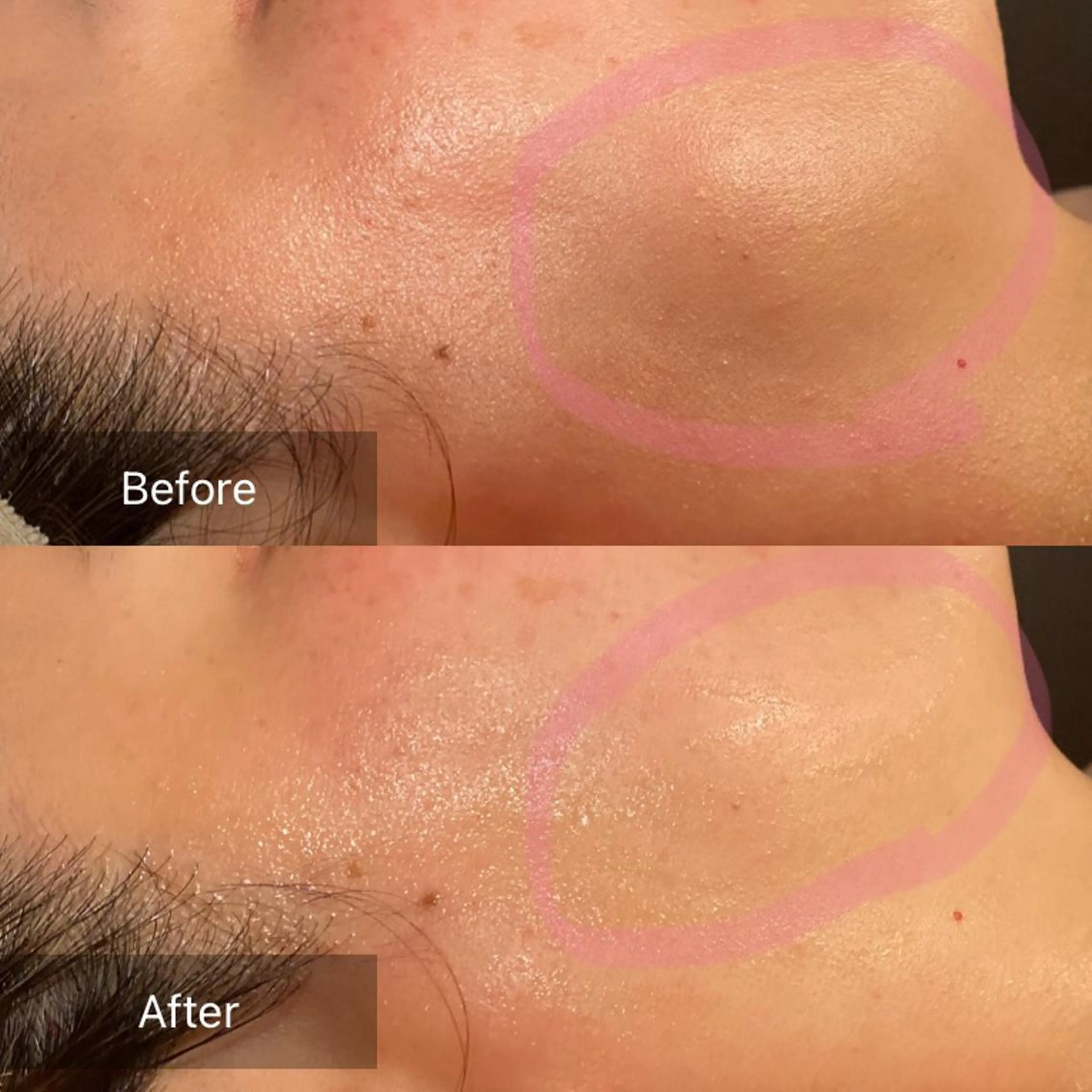 Mandarin Orange所属・毛穴から始める肌メン テマンダリンオレンジのエステ・リラクイメージ