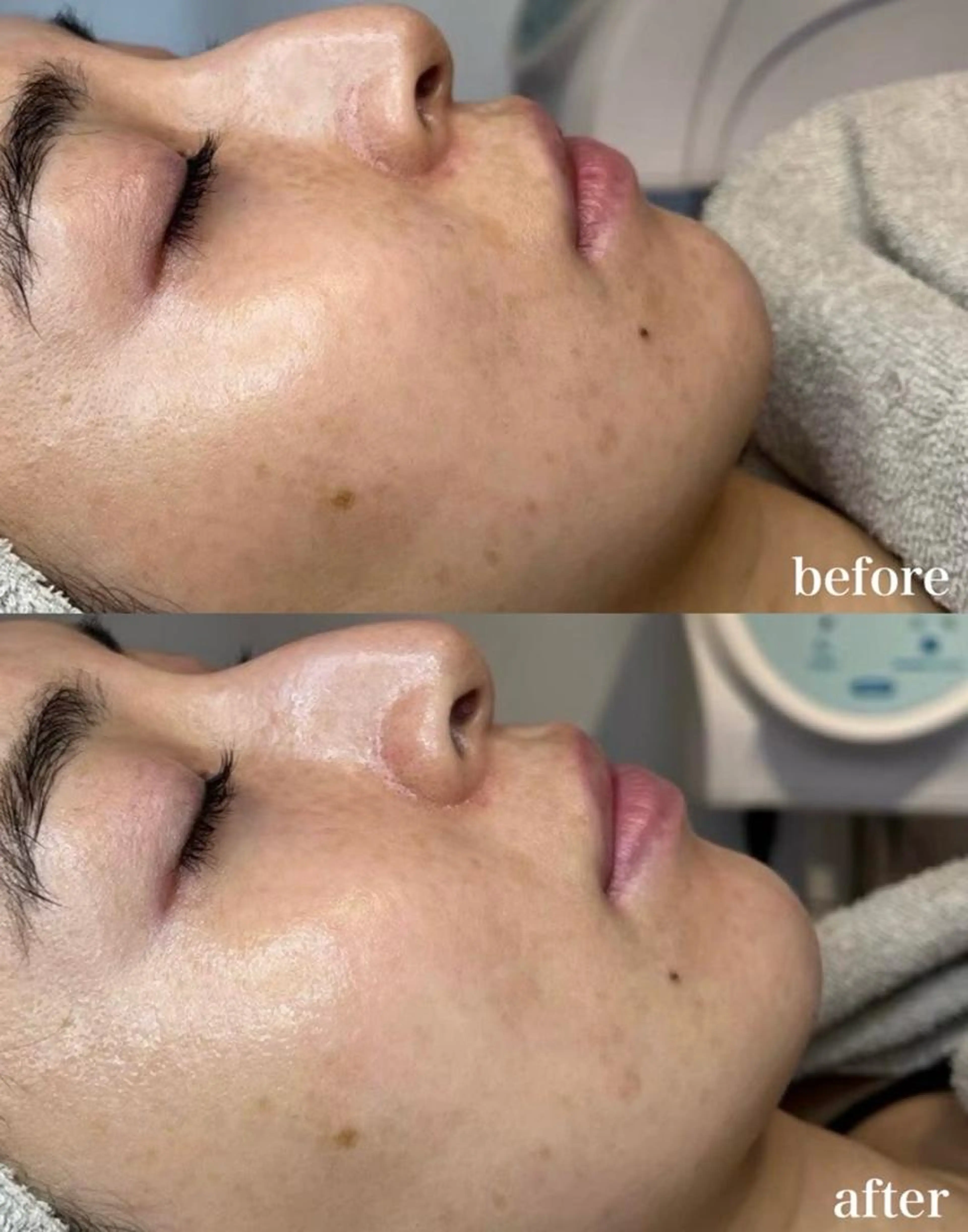 《韓国で大人気！》LHALALAララピールの写真