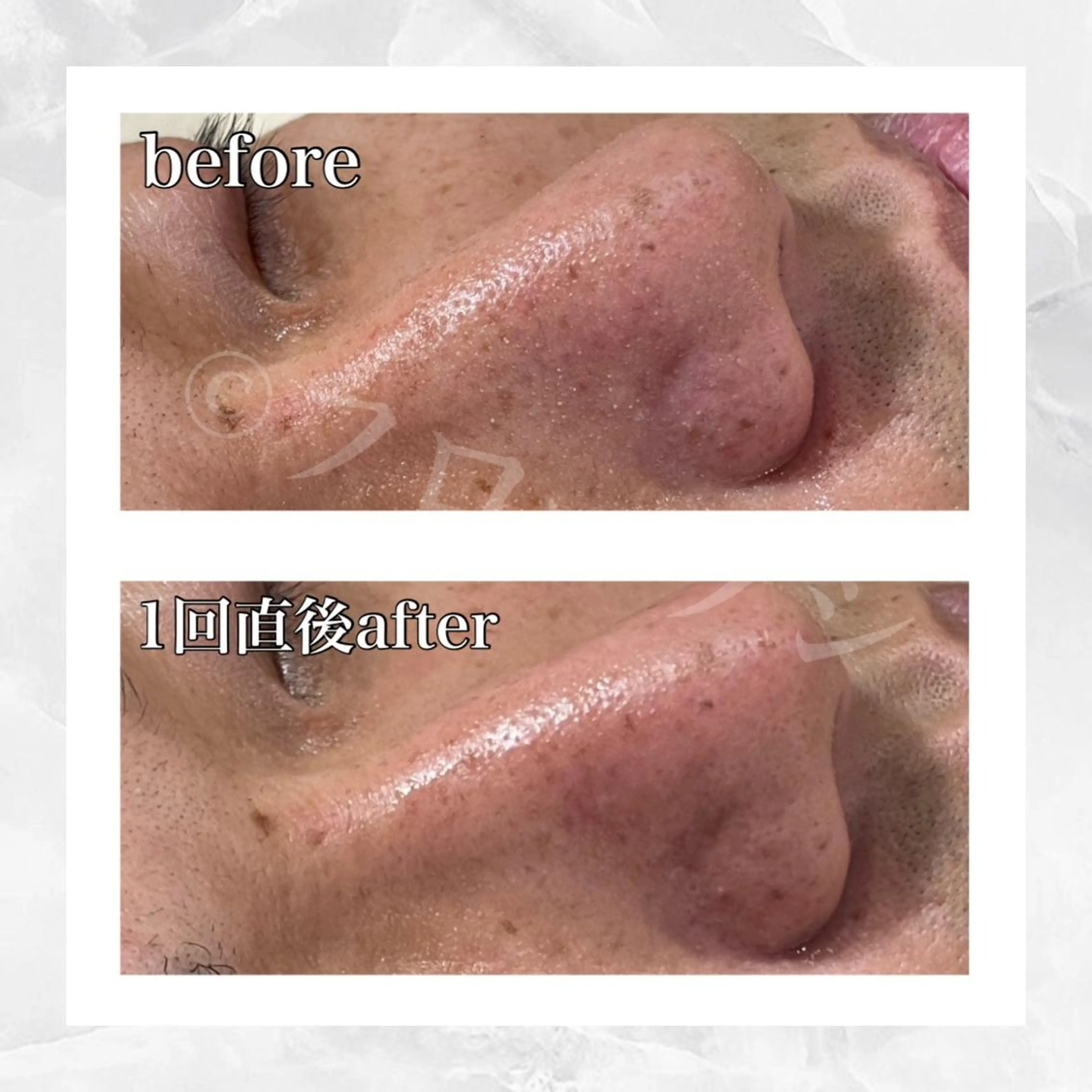 部分痩せ♥️小顔専門 MIKUのエステ・リラクイメージ