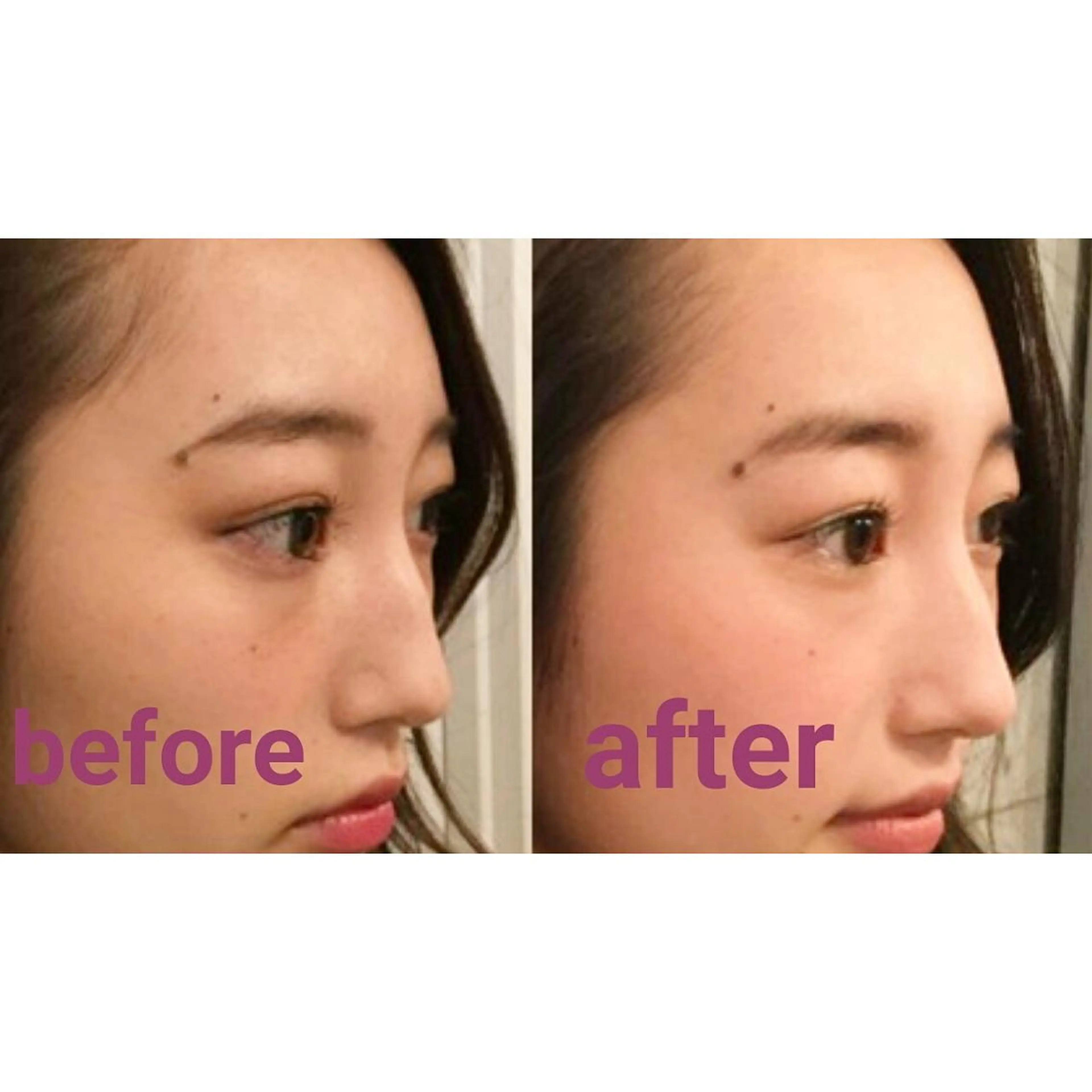 エステ リラク 隆鼻矯正専門店ラプリ 古越のエステ・リラクイメージ