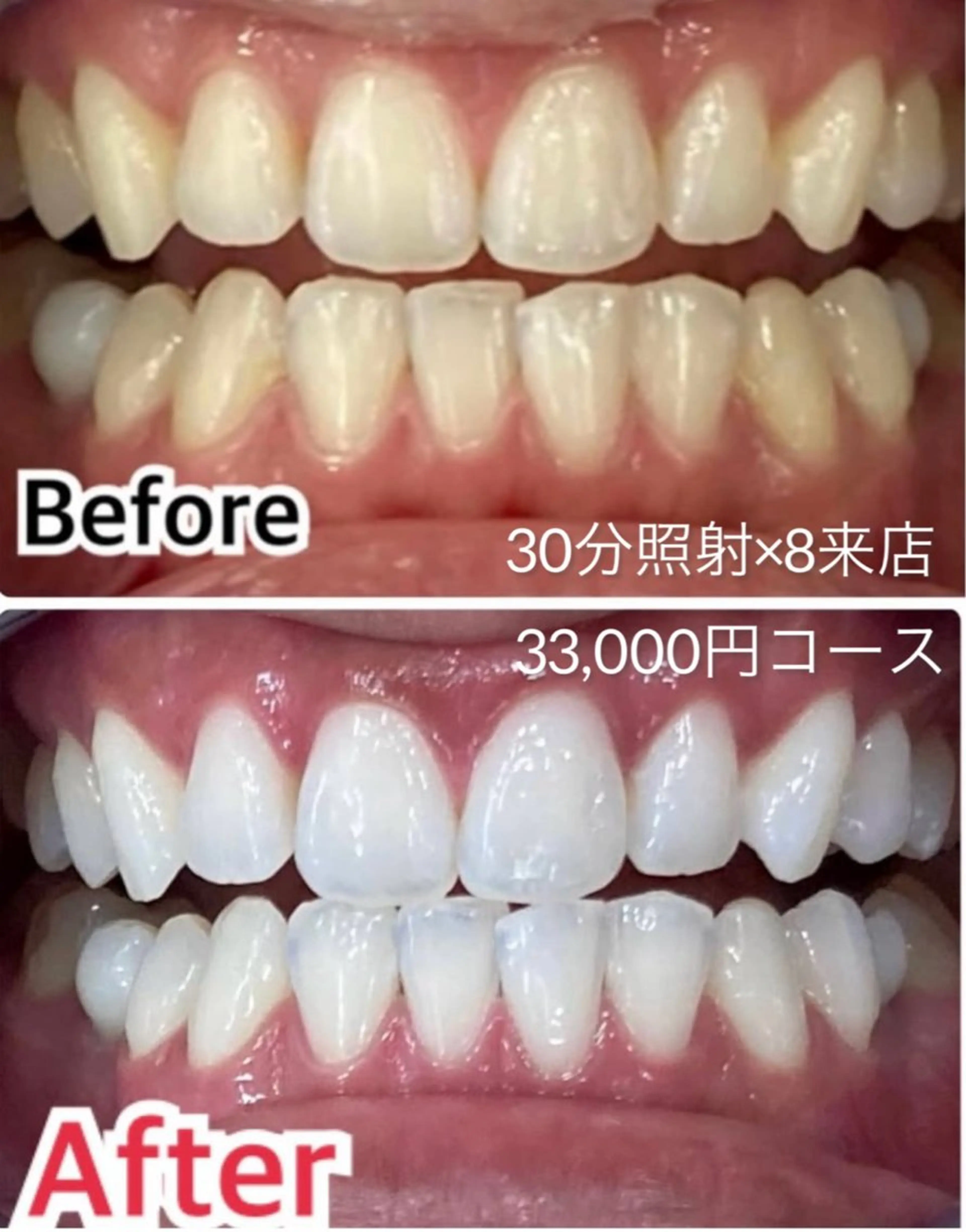 エステ 【歯科提携】柏ホワイ トニングスタイルのその他イメージ