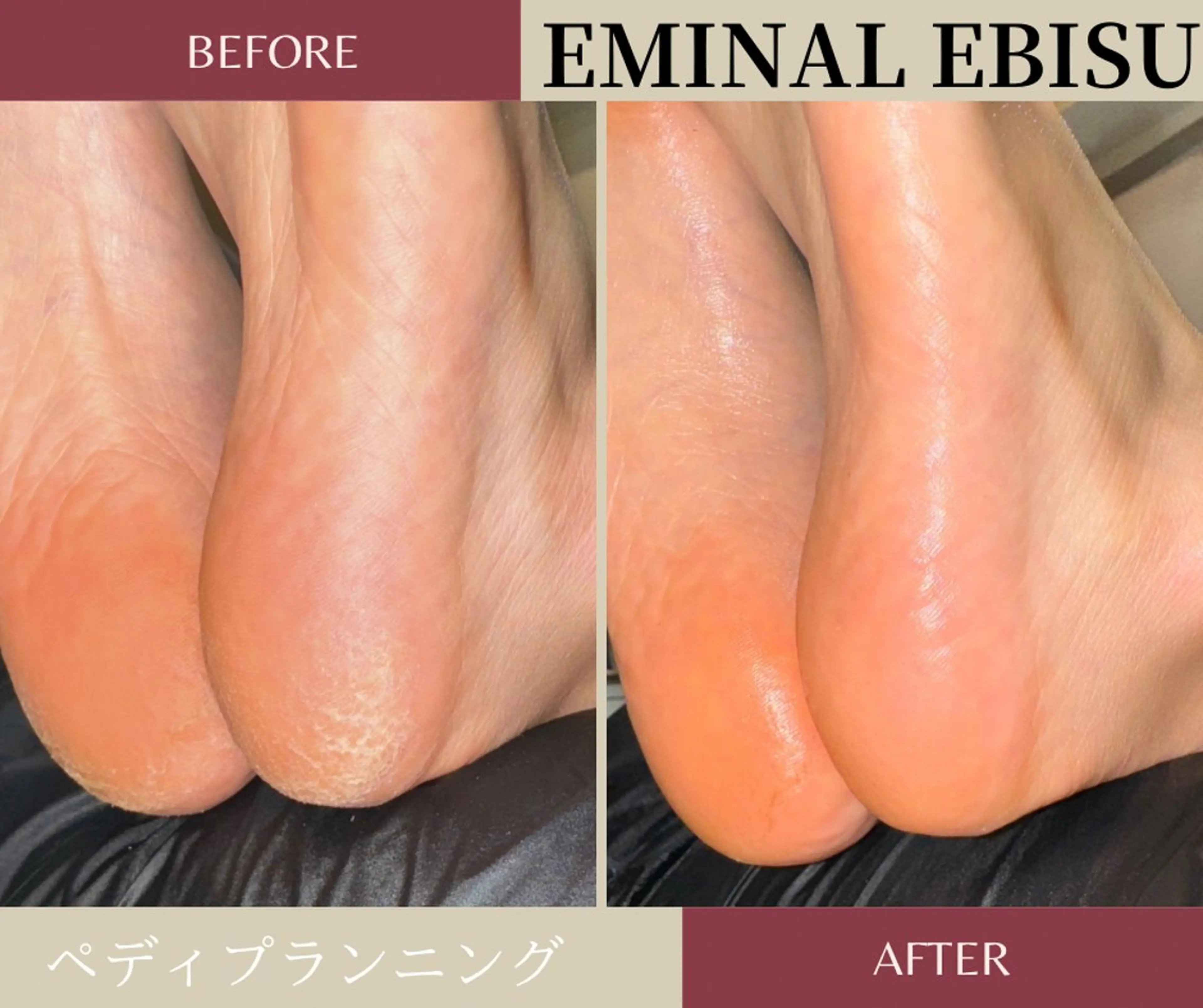 EMINAL恵比寿 HITOMIのエステ・リラクイメージ