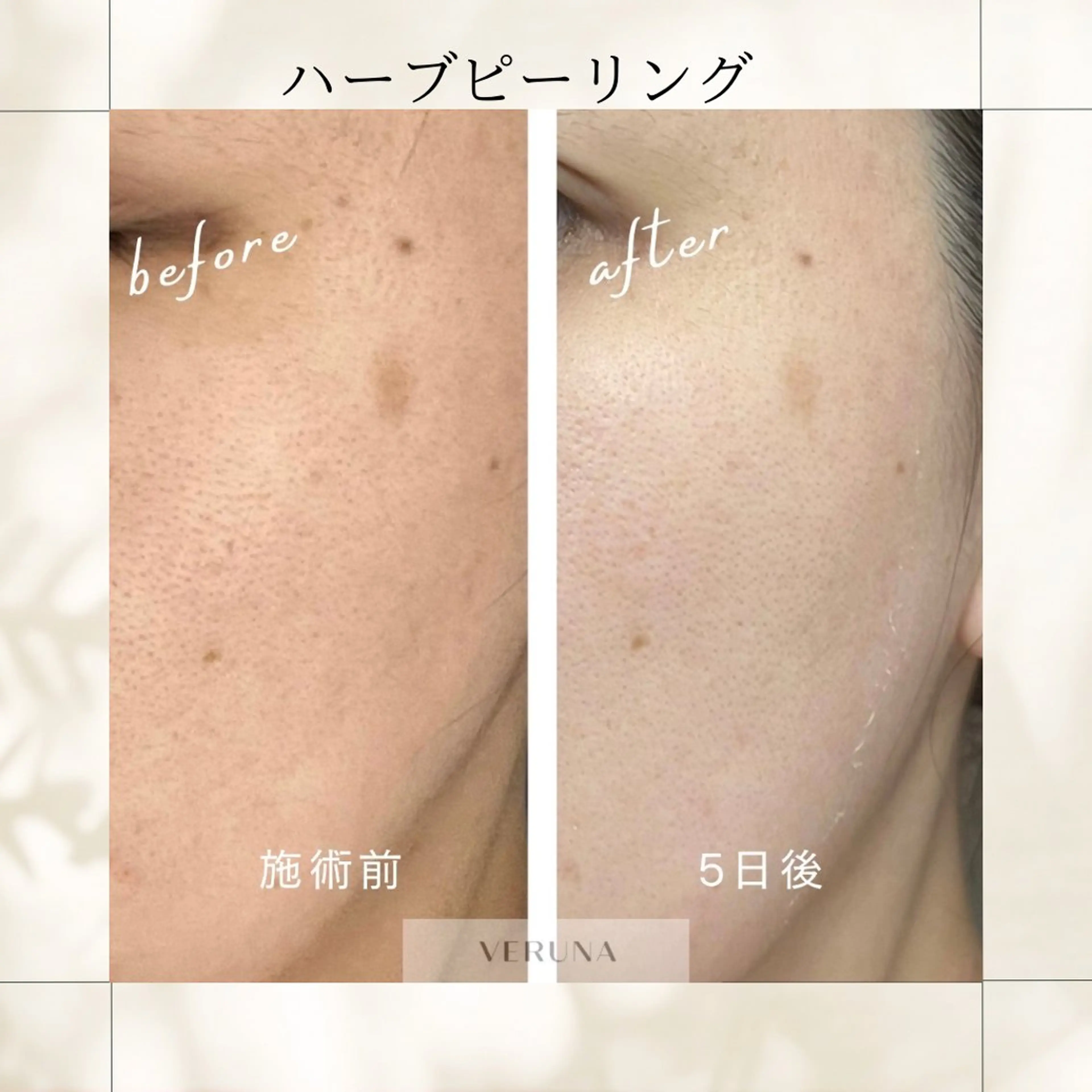 エステ リラク ピーリング専門店 Belluteのエステ・リラクイメージ