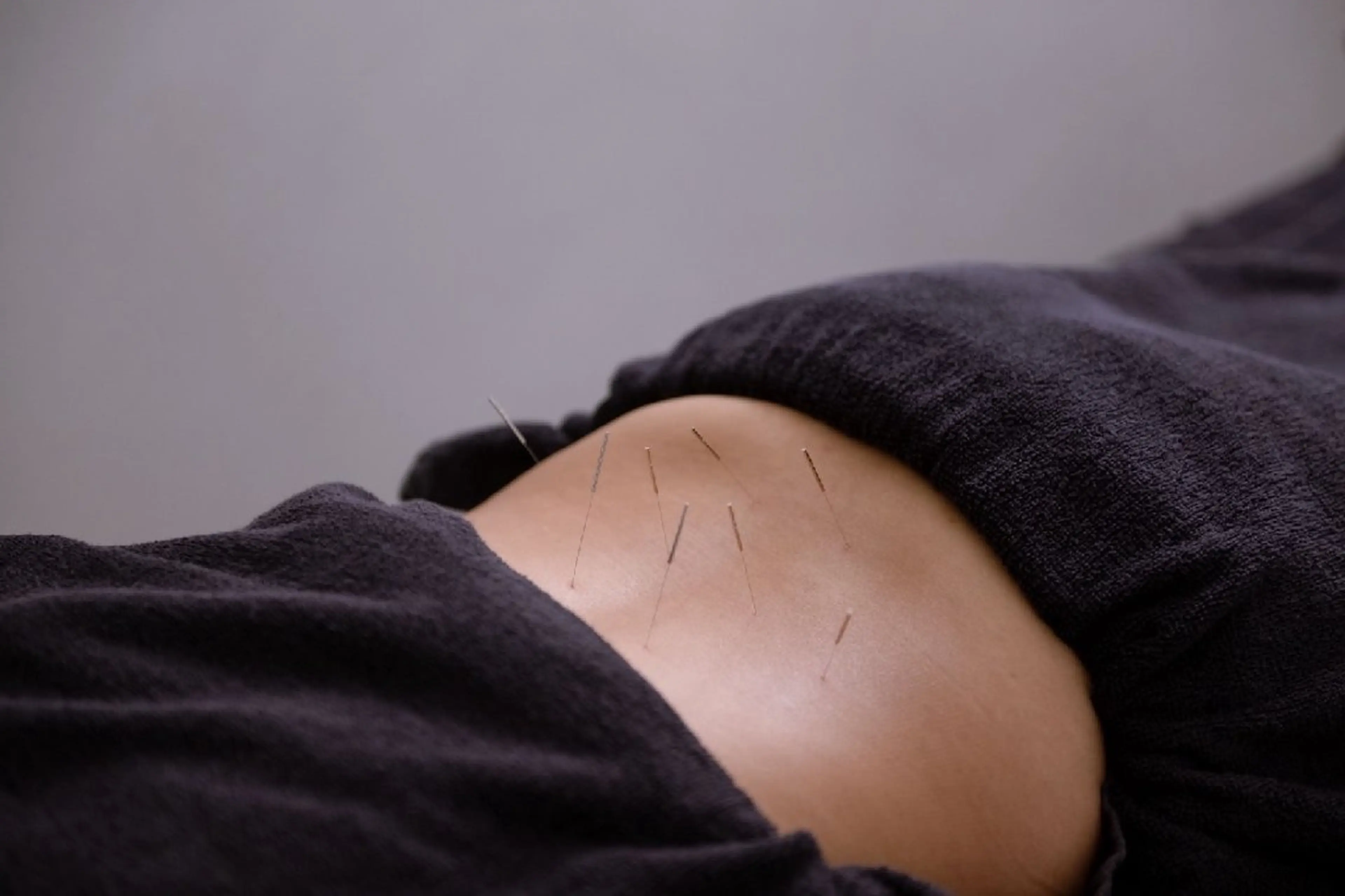 エステ リラク 小顔矯正・美容鍼 FLOW鍼灸整体院のエステ・リラクイメージ