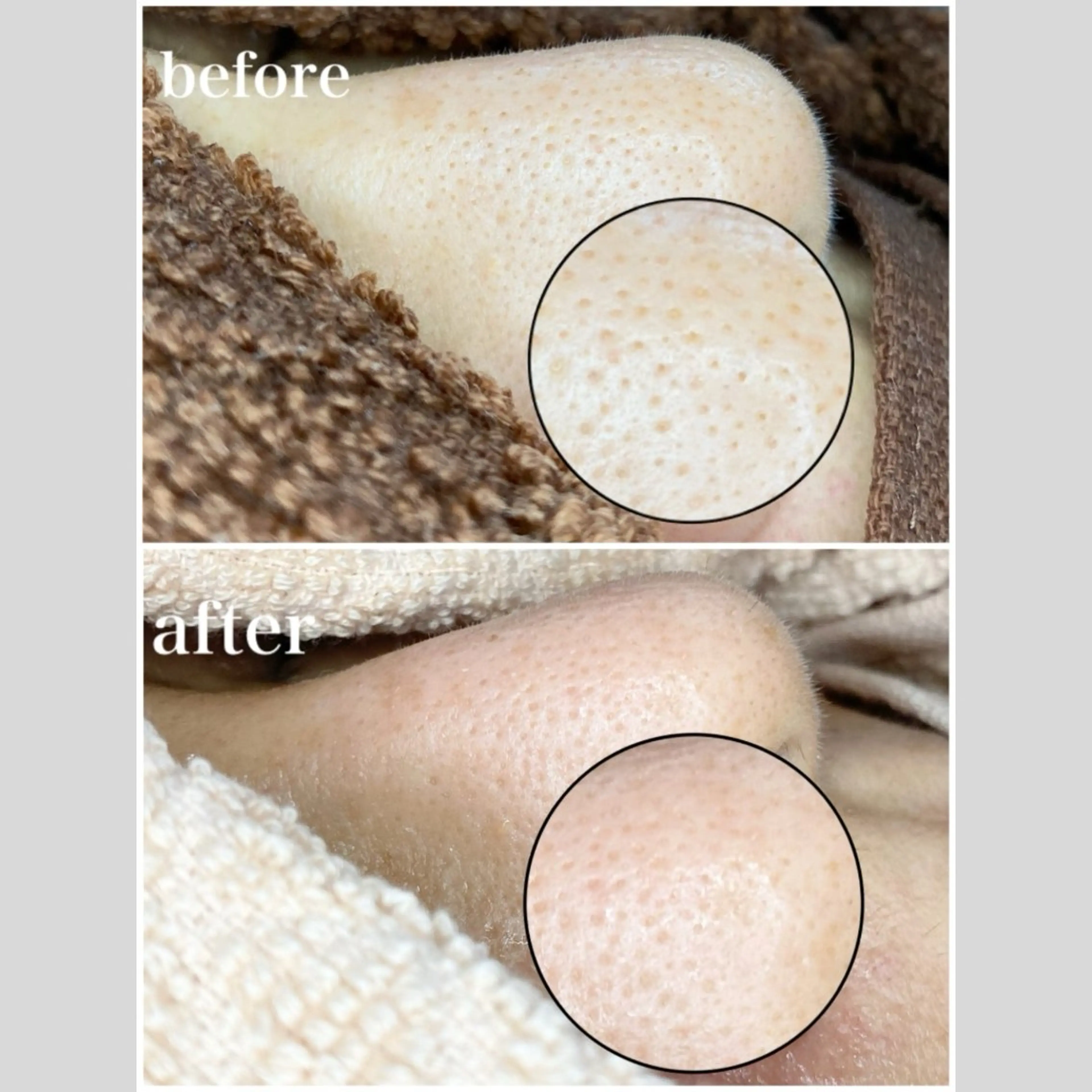 エステ リラク 韓国肌管理 【毛穴専科】のエステ・リラクイメージ