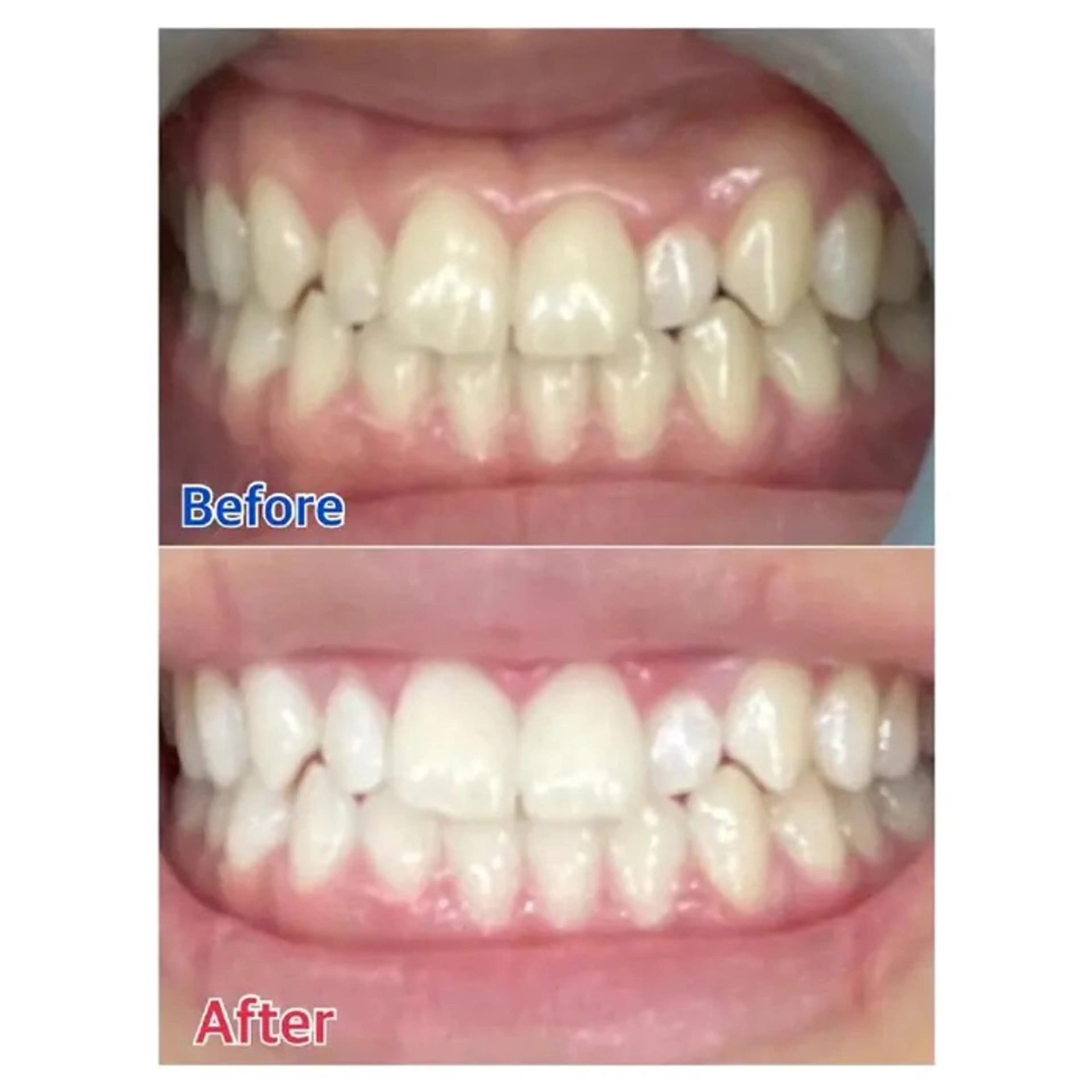 M渋谷 ホワイトニングのエステ・リラクイメージ