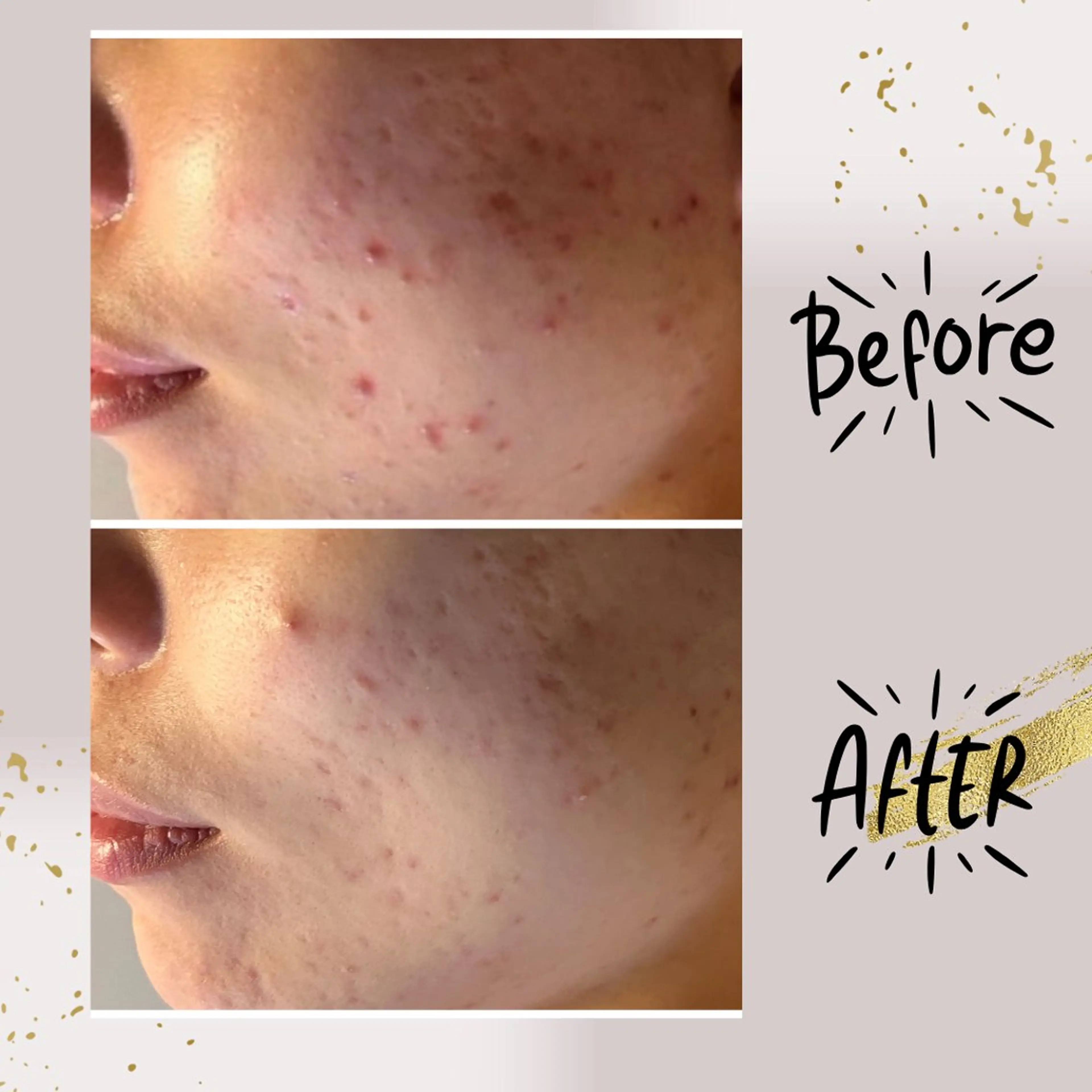 エステ リラク ピーリング専門店 Belluteのエステ・リラクイメージ