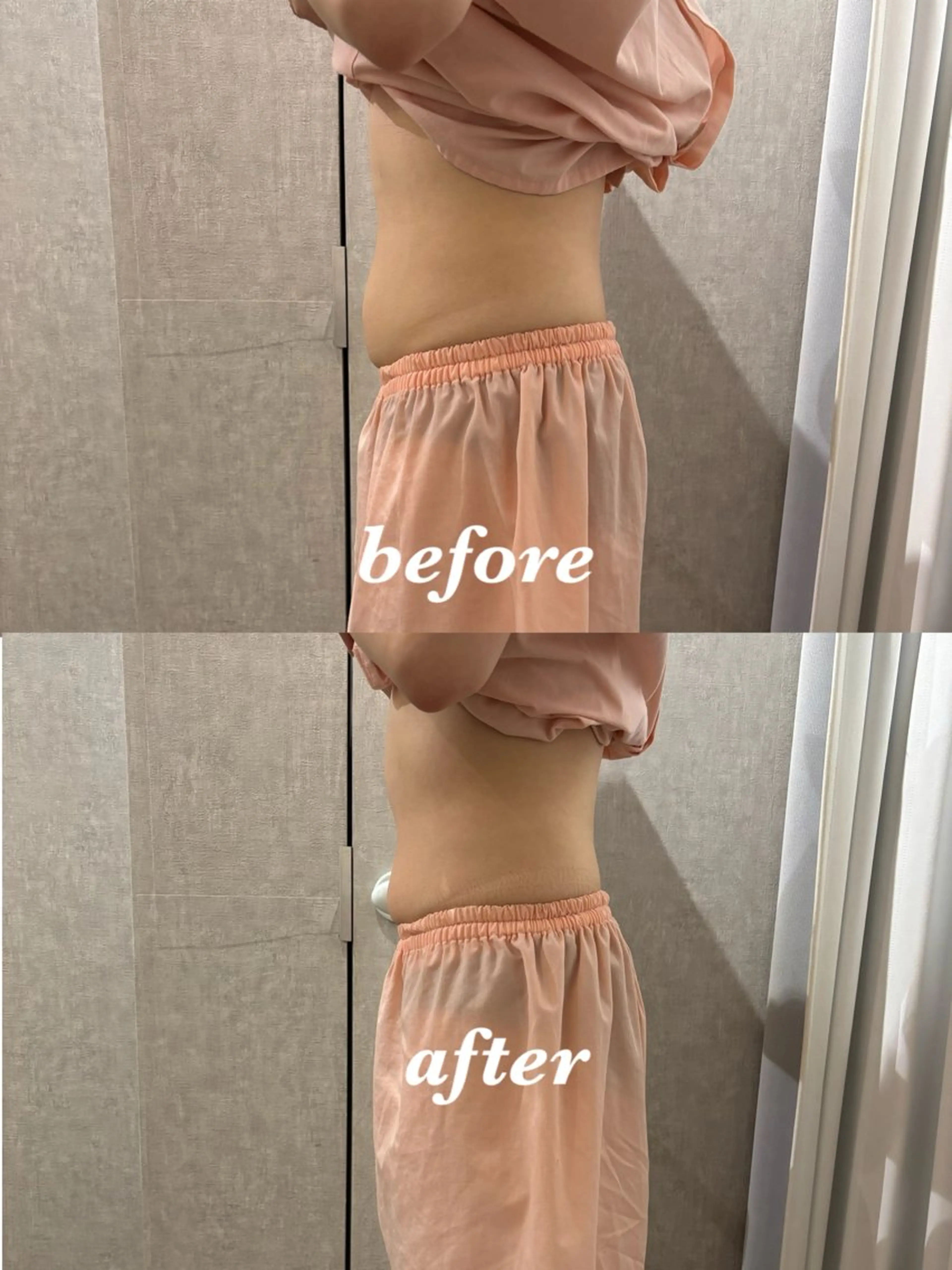 メンズ その他 腸活サポート みなみののエステ・リラクイメージ