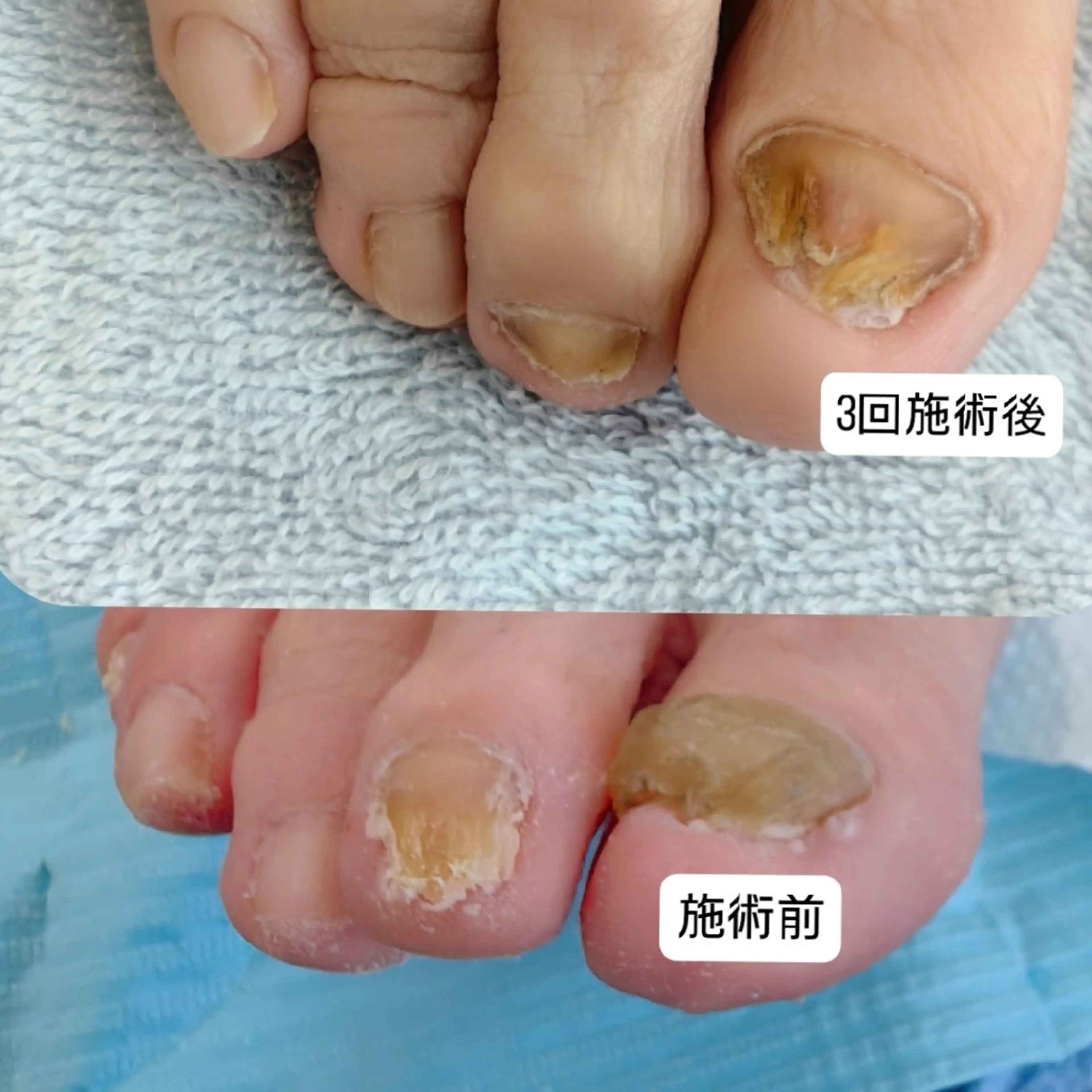 ネイル フットネイル reve あやののネイルデザイン