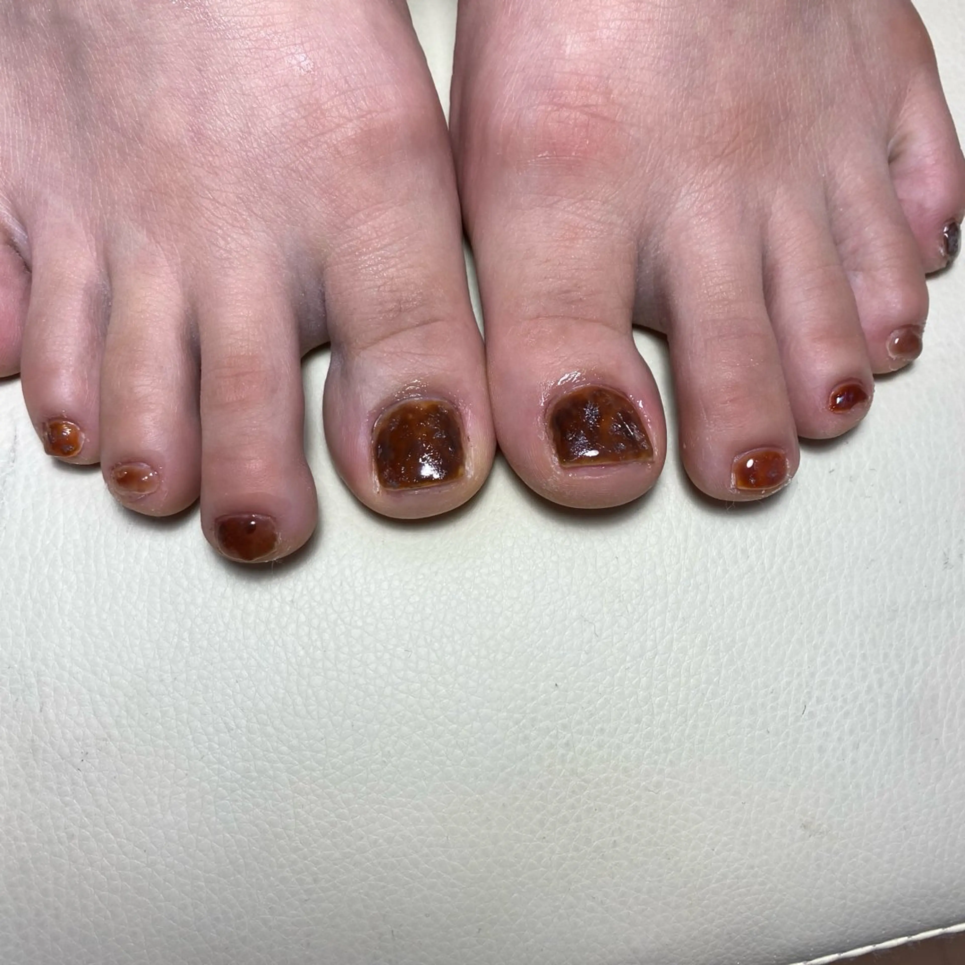 ネイル べっ甲ネイル フットネイル フットネイル COCO+所属・COCO +のエステ・リラクイメージ