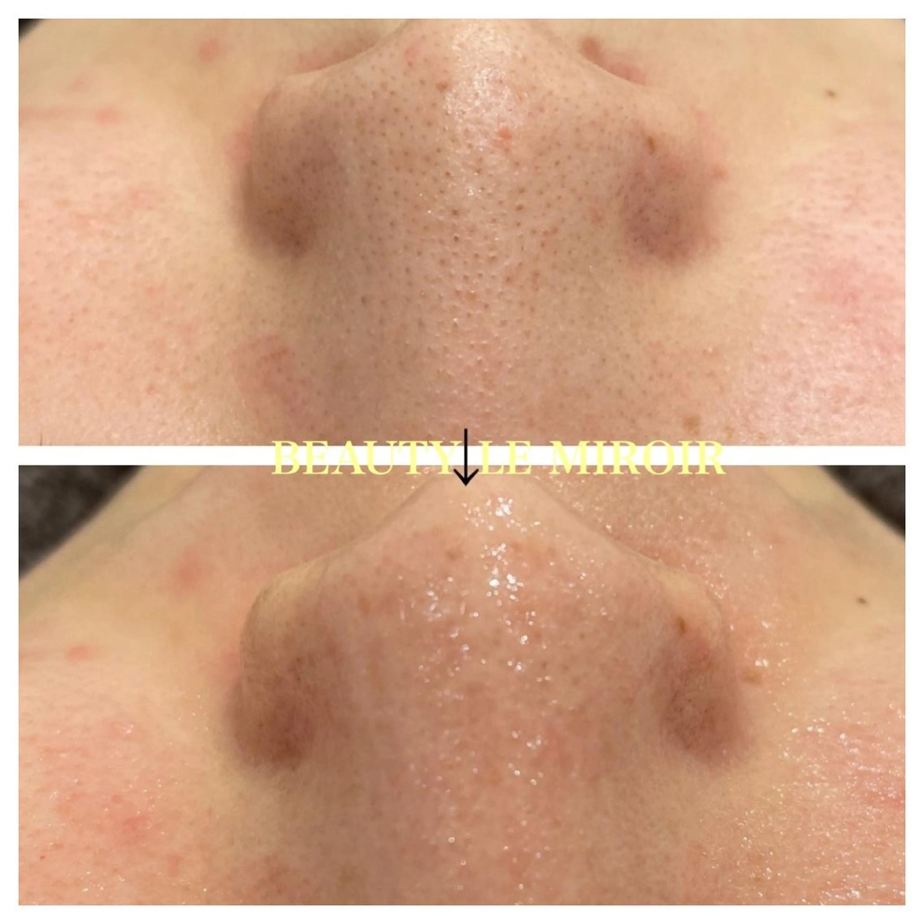 ビューティー ミロワールのエステ・リラクイメージ