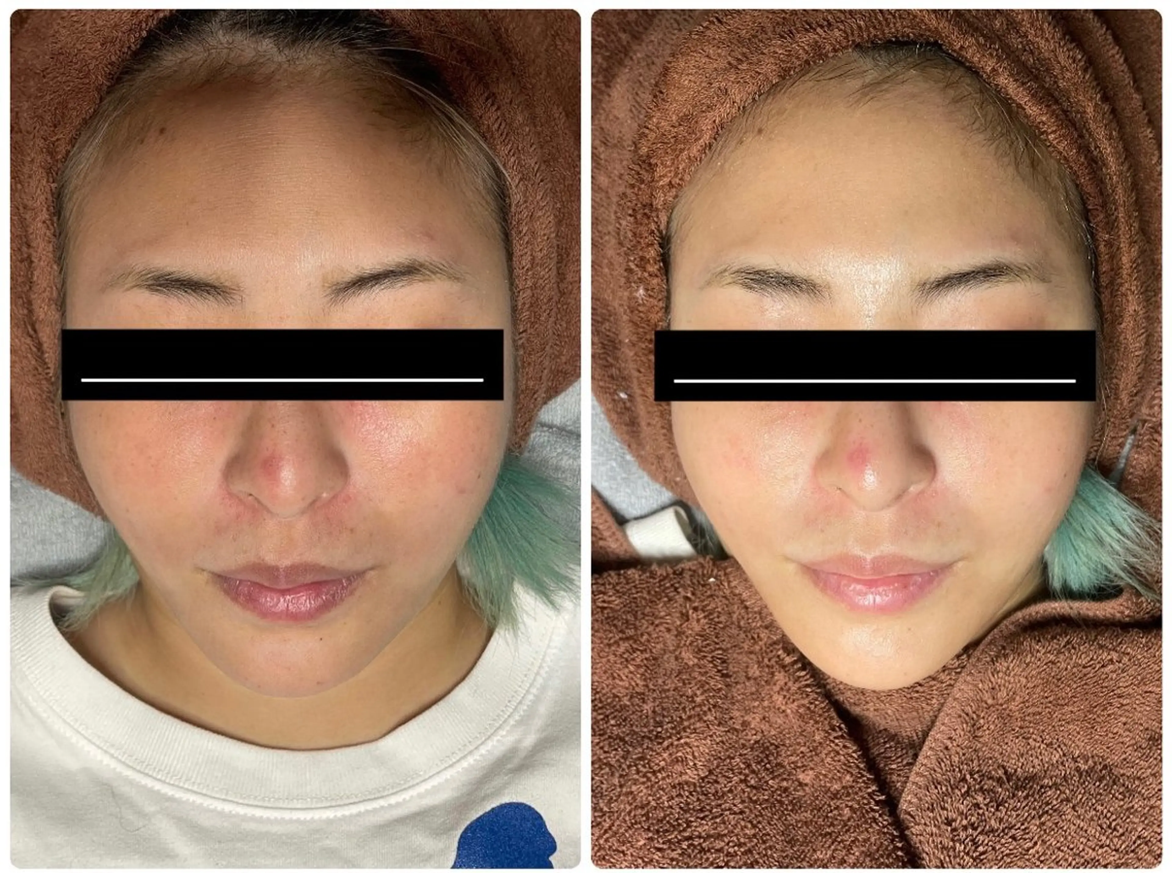 脱毛🌈Beauty Salon新宿店のエステ・リラクイメージ