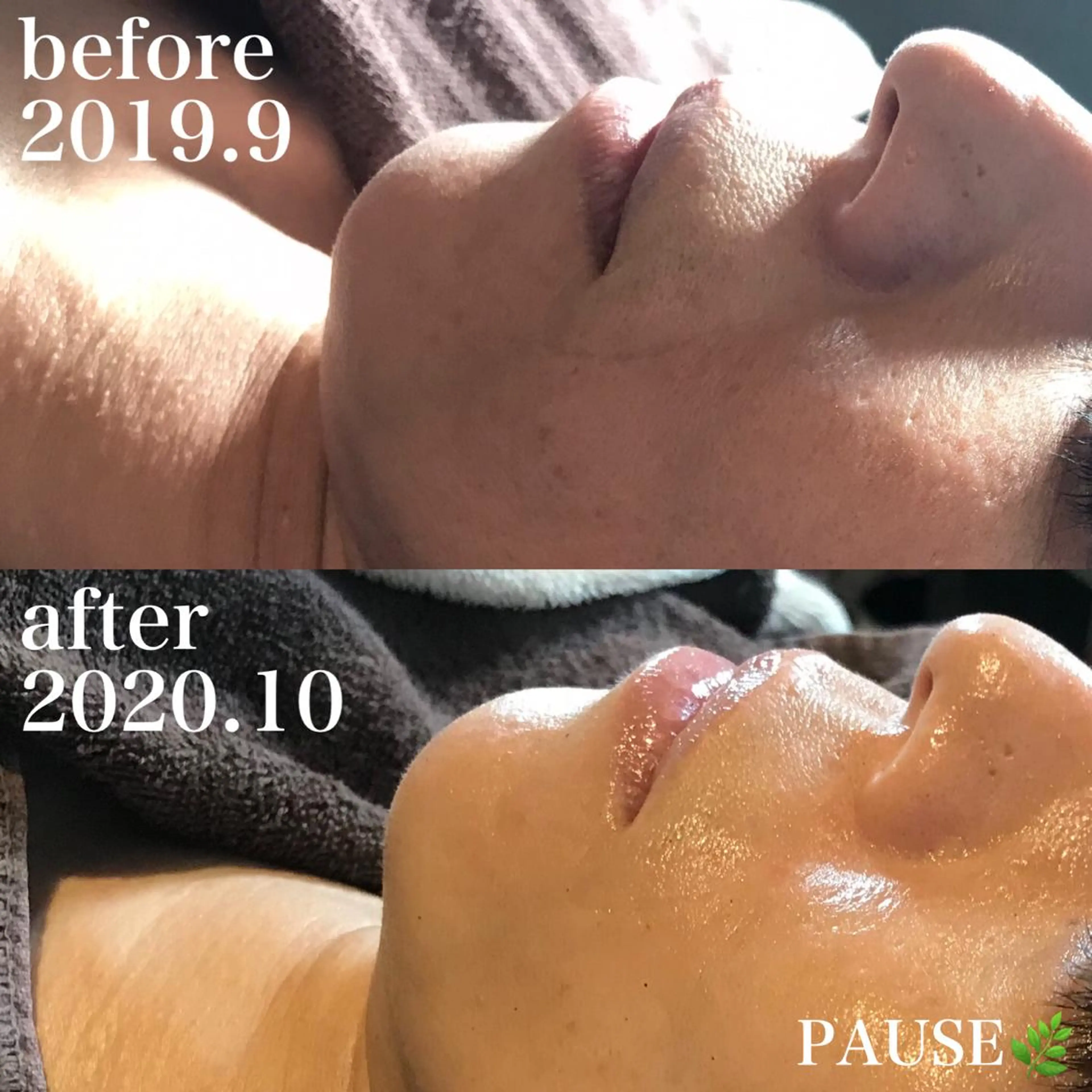 エステ 浜野 恵美のエステ・リラクイメージ