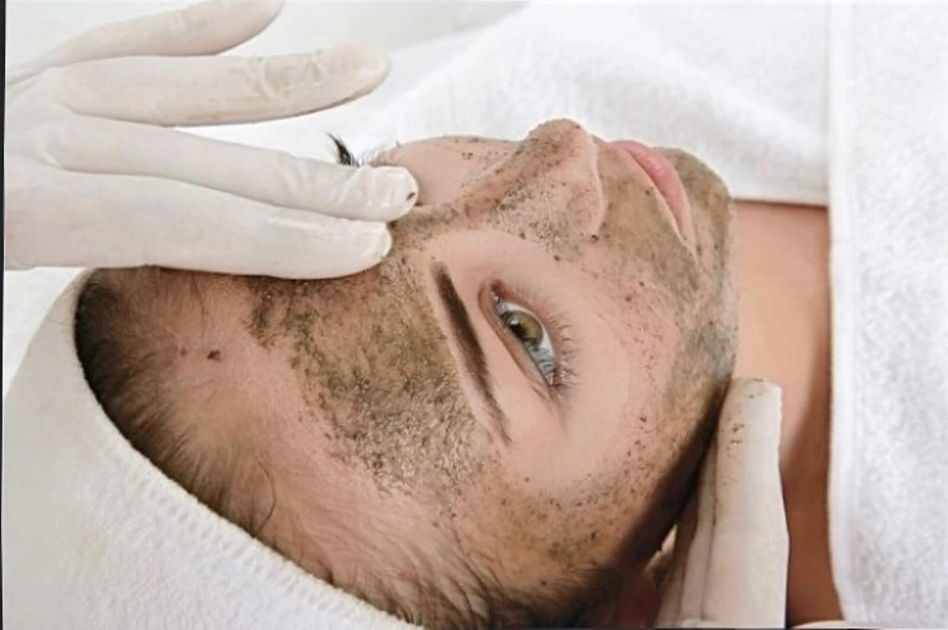 クリスティーナ ローズドメーラ ピーリングの写真